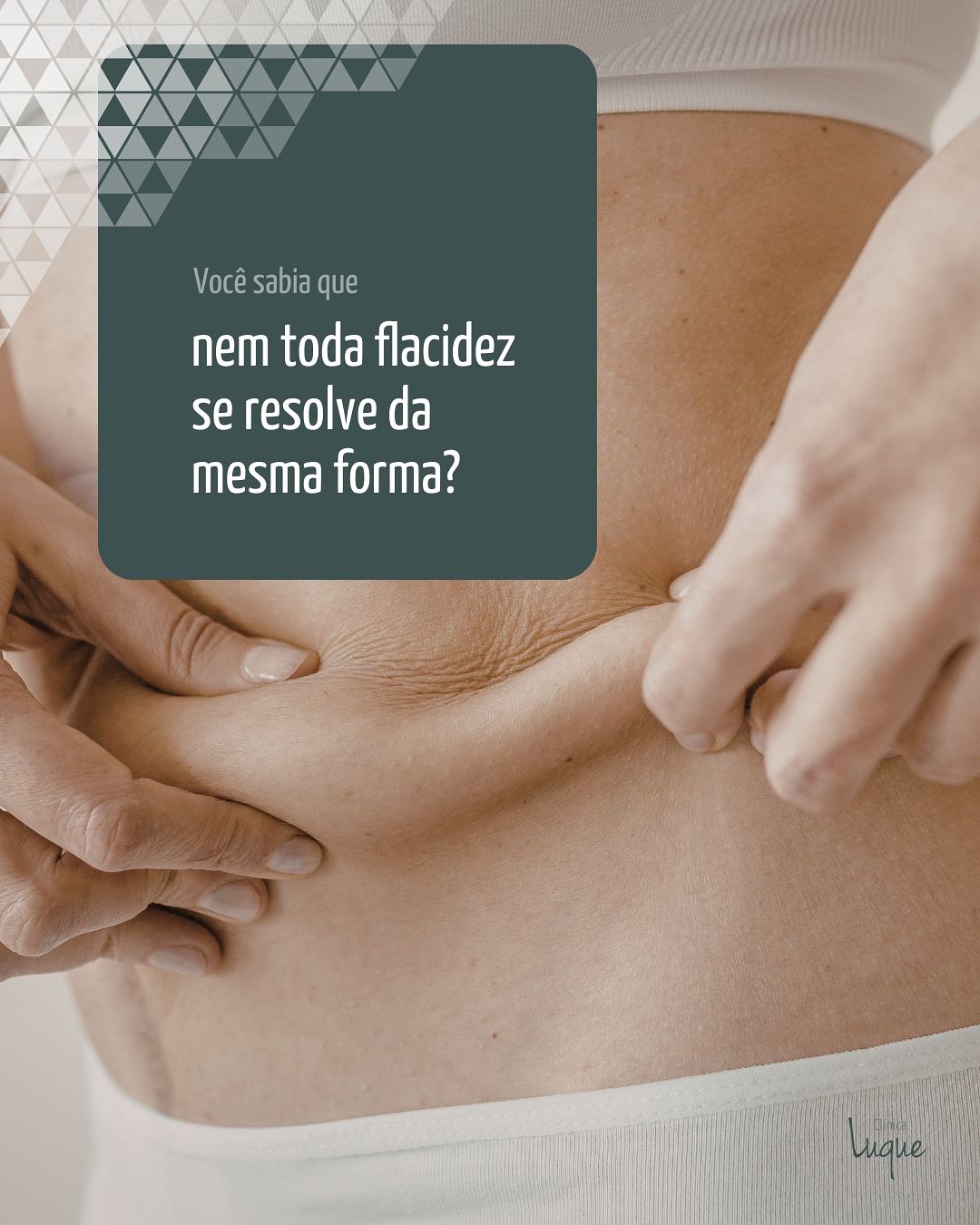 É comum associar flacidez apenas à gordura localizada — mas nem sempre é assim.
A qualidade da pele, a elasticidade e o grau de flacidez fazem toda a diferença na escolha do tratamento.
Lipoaspiração não trata flacidez importante, assim como nem toda flacidez exige cirurgia.
Na cirurgia plástica, técnica e indicação caminham juntas. Por isso, a avaliação individual é essencial.
Será um prazer te receber para uma conversa cuidadosa e personalizada.
🔖 #DrLuque #ClínicaLuque #CirurgiaPlásticaResponsável #CirurgiaPlásticaHumanizada #BelezaComPropósito