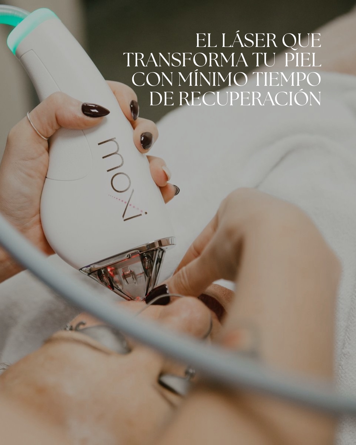 Seguro, eficaz y apto para todos los fototipos.
Incluso las pieles sensibles pueden tratarse, siempre con una correcta valoración médica y un protocolo personalizado.
Porque cuidar la piel no es solo corregir, también es prevenir.
Nos vemos en @estheamedica