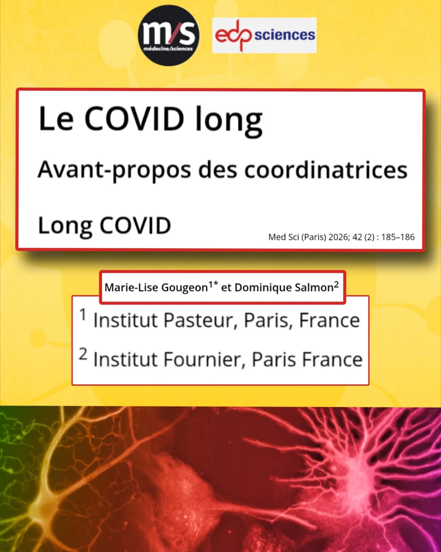 🧵📄 Dans son numéro de février 2026, la revue Médecine/Sciences consacre une série au #CovidLong.
(Pr Dominique Salmon & Pr Marie-Lise Gougeon)
L’un des articles introductifs interroge :
👉 le Covid Long doit-il être considéré comme une maladie chronique émergente ?
Voici les points essentiels à retenir👇
🧑⚕️Dès les premières vagues, des patients ont signalé des symptômes persistants après l’infection.
Mais une partie du corps médical a contesté le lien avec le #SARSCoV2 , attribuant parfois ces symptômes au psychosomatique.
🦠Pourtant, le Covid Long s’inscrit dans une longue histoire de syndromes post-infectieux :
EBV, dengue, Lyme, Ebola…
Déjà après la grippe de 1918, on observait fatigue, troubles cognitifs, cardiaques ou neurologiques persistants.
🌍Contrairement à ce scepticisme initial, le # Covid Long est reconnu depuis 2021 par :
•l’OMS
•la Haute Autorité de Santé
👉La définition OMS :
symptômes ≥ 2 mois apparaissant dans les 3 mois après l’infection, sans autre explication.
📊Selon l’OMS, environ 6 % des personnes infectées développent un Covid Long.
Aux États-Unis, cela représenterait ~18 millions d’adultes.
Les enfants et adolescents sont aussi concernés, et la réinfection augmente le risque. #CovidLongPediatrique
⚠️L’impact individuel est majeur :
•Incapacité à reprendre le travail
•Difficultés scolaires
•Altération profonde de la qualité de vie
💰L’impact sociétal est massif :
Environ 230 milliards $/an aux États-Unis
«860 milliards $ dans l’OCDE»
Le Covid Long est donc aussi un enjeu économique majeur.
🔬Le diagnostic reste clinique (pas de biomarqueur unique).
Mais la recherche a progressé et identifie plusieurs mécanismes plausibles :
•Persistance virale ou antigénique
•Dysfonction mitochondriale
•Activation immunitaire innée
•Atteinte du système nerveux autonome
🧪Ces résultats montrent que le Covid Long possède une base biologique solide,
même si la maladie reste polymorphe et difficile à caractériser.
💊Des traitements symptomatiques existent et sont recommandés par la HAS.
Ils améliorent l’état de nombreux patients, malgré une efficacité partielle.
⏬Suite en commentaire⏬