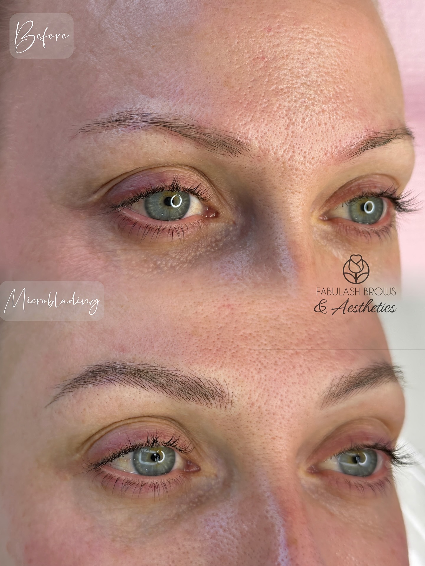 💁♀️Oily Skin??? No problem!!! #microblading by Judy Nguyen will do 😄💪!
It’s hard but possible!
#microbladingwellington #blushhairstrokebrows #nanohairstrokebrows #eyebrowmicroblading