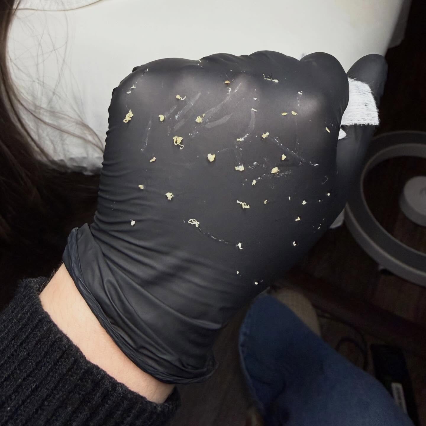 The type of extractions you can get at The Face Place ✨🌿
What is all of this though??? These are extracted from non-inflamed acne, the little bumps on the skin that aren’t red but show off texture. The gunk we get out during extractions is a mixture of dead skin cells, oil, comedogenic hair, skin and makeup products and bacteria 🍋
If you are fighting with your acne, relax and book an acne facial with me! I have openings for new Acne Bootcamp clients too!
Thefaceplacemi.com