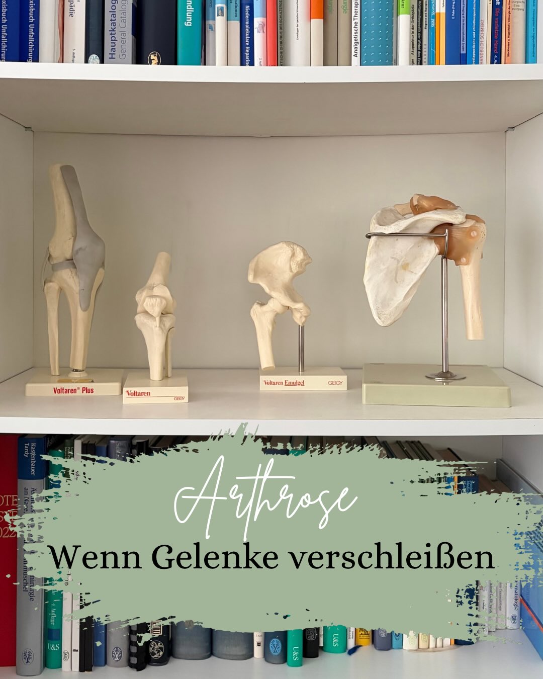 Arthrose ist mehr als „nur Verschleiß“. 🦴
Früh erkannt, richtig behandelt und mit gezielter Bewegung lassen sich Beschwerden deutlich lindern.
Bei Schmerzen oder Bewegungseinschränkungen gilt: nicht abwarten.
Vereinbaren Sie gerne einen Termin in unserer Praxis – wir beraten Sie individuell. 💚
#aoztuttlingen #chirurgie #orthopädie #arthrose #behandlung