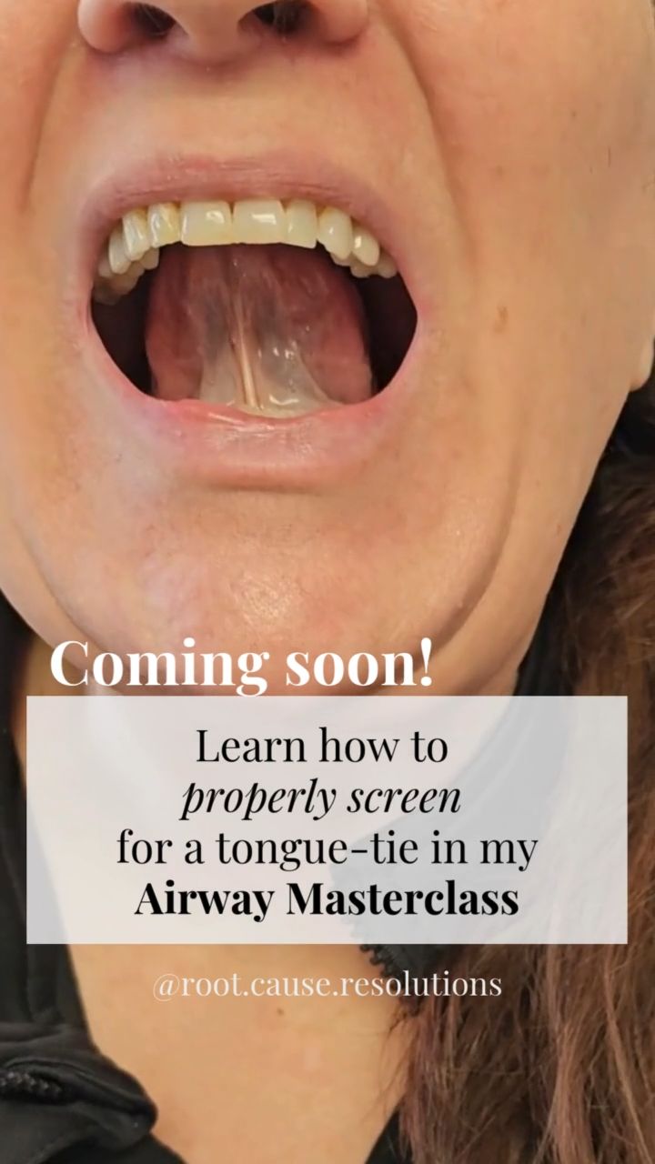 Proper tongue-tie screenings require more than a quick visual check. It requires understanding anatomy, biomechanics, compensations, and validated assessment protocols.
✅️ How to distinguish appearance from function
✅️ Following evidence-based screening frameworks
✅️ Understanding compensation patterns that mask restriction
✅️ Documentation and referral pathways
🌟 Grounded in current literature and interdisciplinary standards of care, my Airway Integration Masterclass is designed for providers who want reproducible, defensible protocols — not guesswork.
🙌 If you’re ready to screen with clarity and clinical confidence, this is where to start.
Join the waitlist to be notified when enrollment opens & tag your dental friends who want to elevate their standards!
#dentistry #airwaymanagement #tonguetie #sleep #rdh