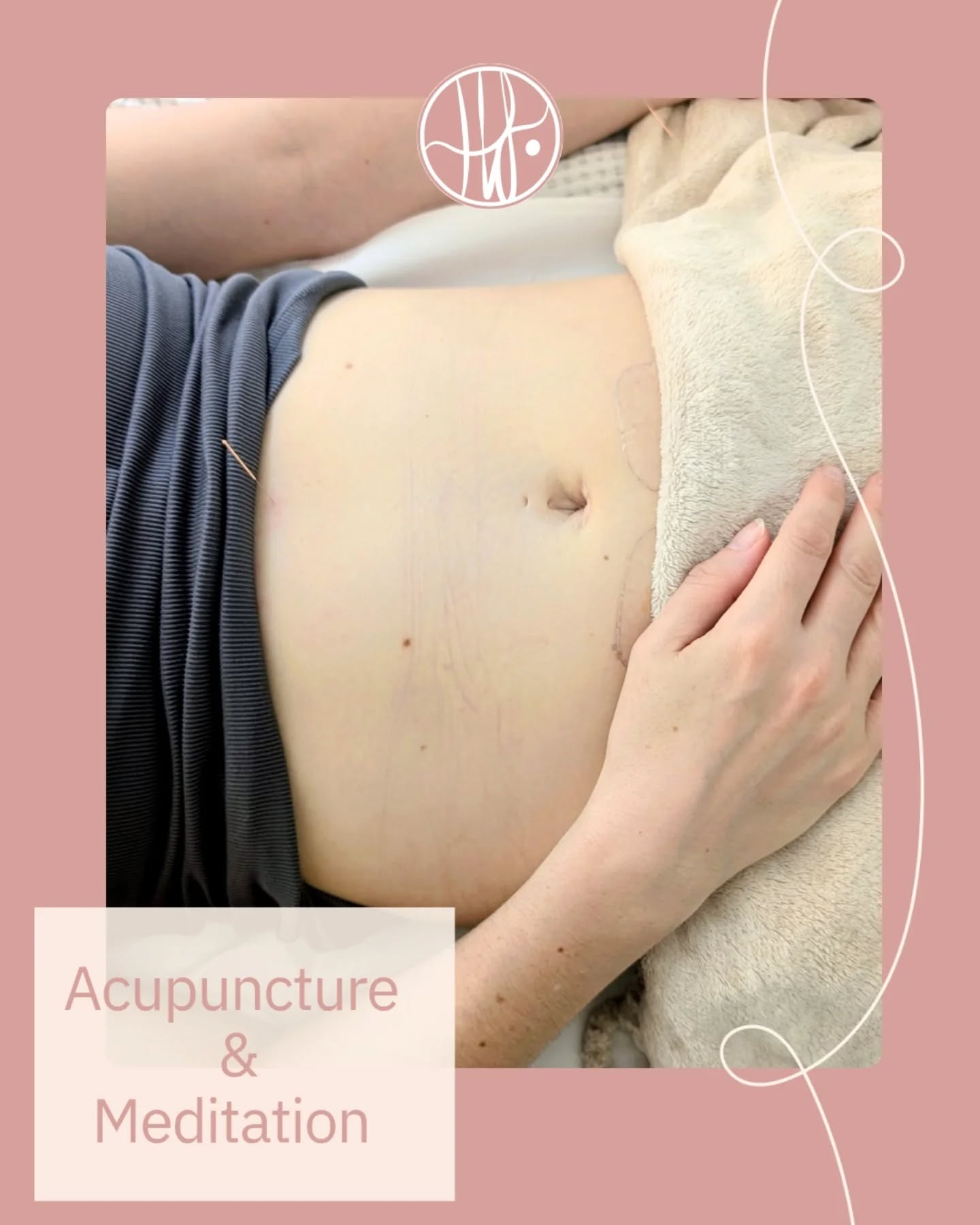 I love weaving meditation into the treatment room āØ
Giving the conscious, thinking part of the brain something gentle to focus on allows the body to truly soften. When the mind feels held, the nervous system can switch out of ādoingā mode and into deep rest ā where healing begins.
āØ
Meditation also allows each treatment to become more personal. No two sessions are ever the same, because no two journeys are the same.
āØ
Last nightās meditations explored:
⢠Supporting yourself through your inner autumn phase
⢠Accepting that fear and joy can coexist in early pregnancy
⢠Releasing stored tension from the body
⢠Reclaiming power and hope along your journey
āØ
All held within a beautiful space of smoky moxa, Reiki, and deeply restorative energy work.
āØ
Because sometimes the most powerful part of treatment isnāt just what happens physically ā itās what shifts quietly within.
āØ
#holistichealing #meditationpractice #energyhealings #mindbodyconnection #personalisedcare