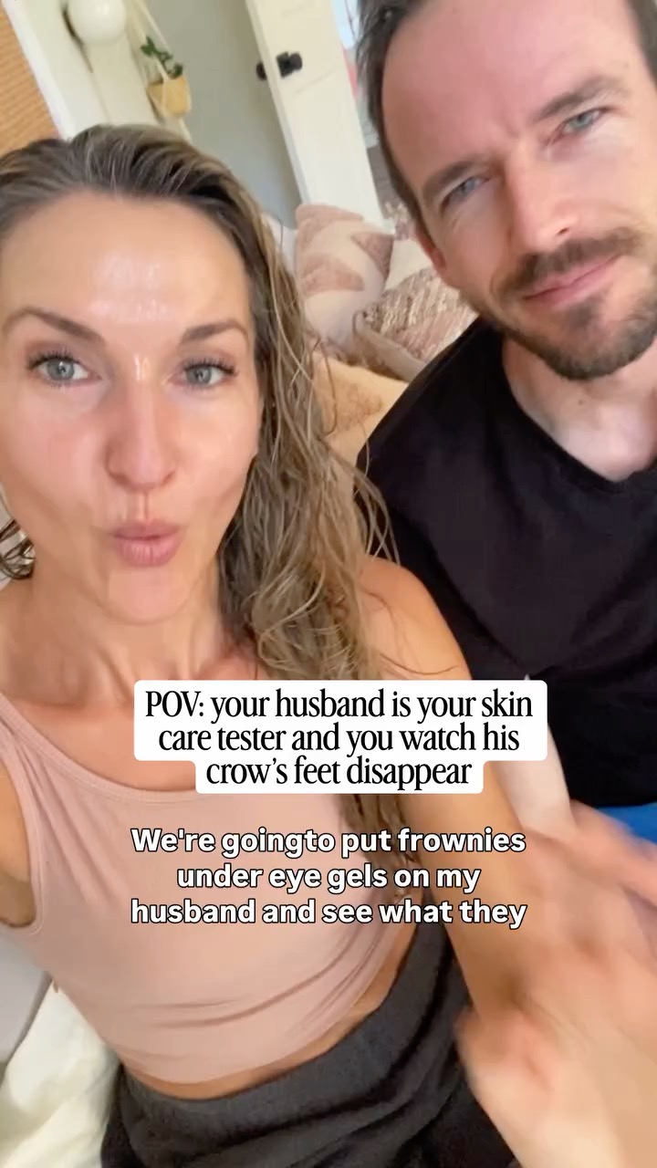 If you’re under eyes are giving Sahara Desert instead of plump and dewy… this is your sign.
I actually put these on my husband because he has a lot more going on under his eyes than I do, and I wanted a realistic demo of what’s possible.
His results were noticeable almost immediately. Slightly brighter. Less puffiness. Fine lines looked smoother.
They’re great in the morning when you want to look a little more awake before starting your day. But they’re not just a quick refresh. Over time, they’re formulated with cactus collagen, aloe, and niacinamide to support healthier-looking skin with consistent use.
I think the before and after speaks for itself. What do you think?
#undereyegels #eyegels #frowniescanada #finelines #darkcircles #smoothskin