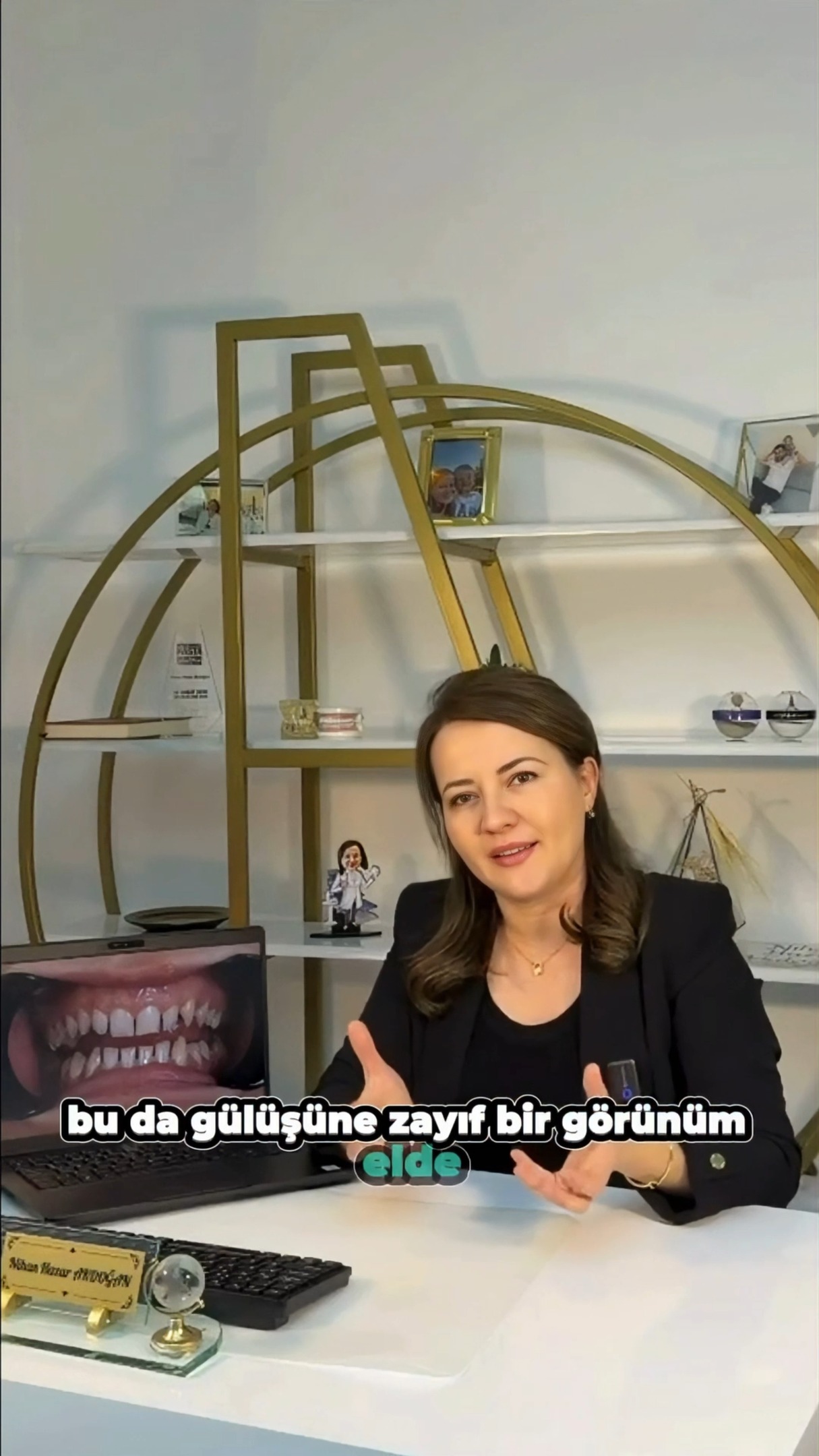 Lamine Porselen Kaplama Nedir? Vaka Anlatımı
Bu videoda, estetik beklentileri bulunan bir hastamız için planlanan lamine porselen kaplama uygulama sürecini klinik yaklaşım çerçevesinde paylaşıyoruz.
Lamine kaplamalar; dişlerin ön yüzeyine minimal aşındırma ile uygulanan, estetik ve fonksiyonel düzenlemeyi hedefleyen porselen restorasyonlardır. Tedavi planlaması; hastanın ağız içi muayenesi, fotoğraf analizi ve ölçü aşamalarından sonra kişiye özel olarak yapılır.
Vakamızda; diş formu, renk uyumu ve gülüş hattı değerlendirilerek doğal bir görünüm hedeflenmiştir. Uygulama süreci ve sonuç, hekimin klinik değerlendirmesi doğrultusunda planlanmıştır.
📌 Her tedavi kişiye özeldir. Uygunluk ve süreç, detaylı muayene sonrası belirlenir.
📌 Bu içerik bilgilendirme amaçlıdır, tanı ve tedavi yerine geçmez.
#laminekaplama #yaprakporselen #estetikdişhekimliği #gülüştasarımı #dişestetiği #ağızvedişsağlığı #başakşehir #kayasehir