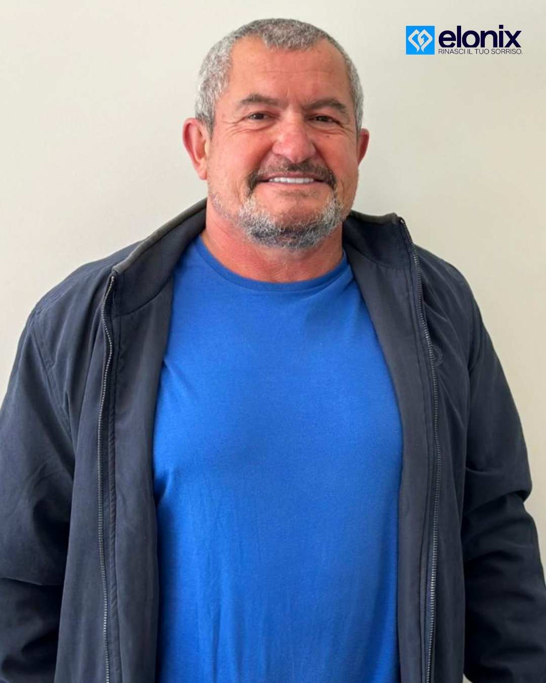 #elonix #elonixdentalclinic #elonixclinic #chiurgiamaxillofacciale #elonix #elonixdentalclinic #elonixclinic #chiurgiamaxillofacciale #clinica #elonix #estetica #salute #denti #dentista #impianti #turismodentale #turismodentalealbania #turismodentaletirana #turismodentaletiranaalbania #zircone #tirana #dentalsurgery #dentalveneers #dentalwork #laboratoriodentale #panoramica #scaner3d🦷 #dentifissi #sorriso #dentalsolutionsisrael #dentistica #sorridere