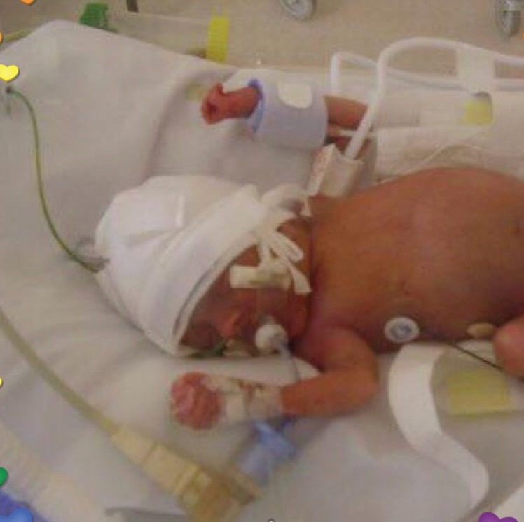 *trigger warning* baby loss ….. 🥹
Watching the Gordan & Tana Ramsey series tonight on @netflixuk (really good and content ☺️) and they were celebrating their daughter’s engagement, getting excited about the wedding… and it just hit me.
There are so many “firsts” I’ll never get to see with Lillie.
And for some reason, tonight it was her wedding.
I’ve never really let my mind go there before. I’ve thought about birthdays, school runs, milestones… but not her walking towards her person. Not the dress she might have chosen. Not the way she’d have looked at the one she loved.
I have my boys, and one day I might get to stand at their weddings. And I know that will be beautiful.
But there’s something about imagining Lillie’s that feels so quietly heartbreaking.
It’s the “what ifs” that sneak up on you, isn’t it?
I miss her so much. Always have. Always will.
And tonight I just found myself wondering about the wedding she might have had, with the perfect partner she would have chosen. 🥹💗🌈
For Lillie
I don’t always speak you loudly,
but you are never far.
You live between the rainbows,
in the quiet of my heart.
In moments no one else can see,
when life feels full and bright,
I sometimes stop and wonder
who you would be tonight.
Would you laugh the loudest in the room?
Would you hold somebody’s hand?
Would I be fixing your dress before
you walked toward your chosen person?
There are firsts I’ll never witness,
paths I’ll never see you take
but love does not need milestones
to prove it didn’t break.
So I carry you in colour,
in bubbles, pink and light.
Not always with my tears, my girl
but always in my sight.
Forever my daughter.
Forever my why. 🌈💗
#babyloss #bubbletime #makingmemories
@gordongram @tanaramsay