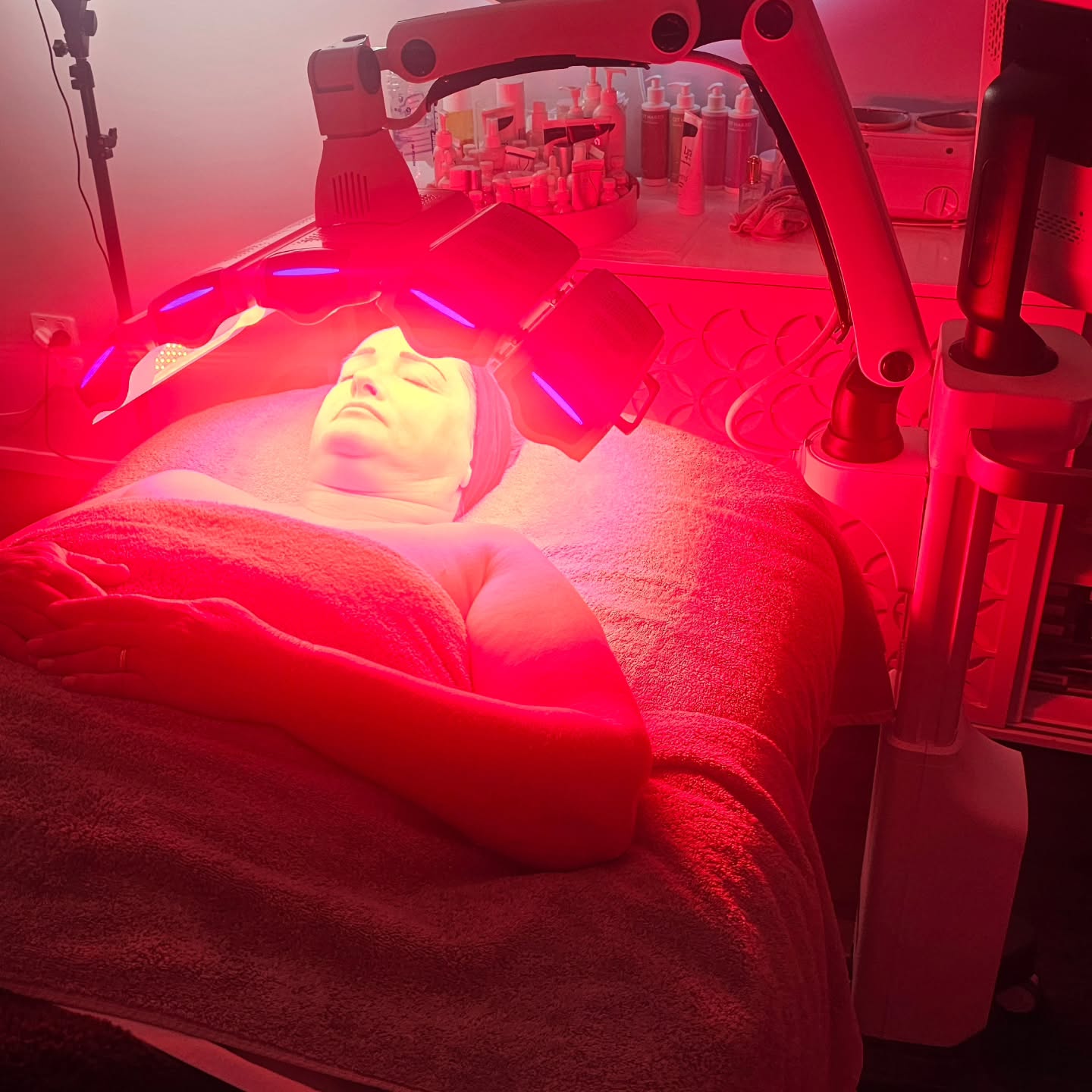 Red and yellow treating melasma. I absolutely love the yellow 590 wavelength on my in salon device. So many benefits from capillaries, burns, stimulates red blood cells so great after surgery, bruising, pigmentation and uv damage! This is why @themask_anz has this wavelength