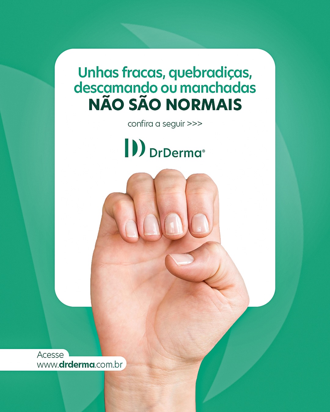 Fique atento aos sinais que suas unhas dão. Ao perceber qualquer um deles, agende sua consulta com um dermantogista pelo link da bio. www.drderma.com.br