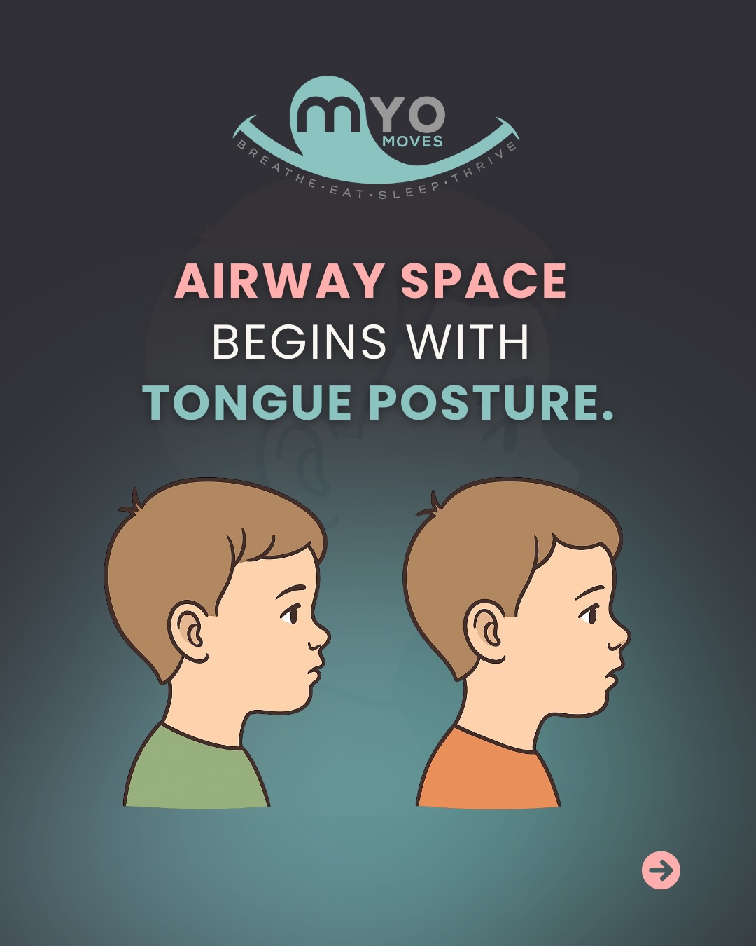 Could your child’s tongue be holding them back?
Where the tongue rests for most of the day actually shapes jaw growth, airway space, and how well they breathe.
Low tongue posture = less room for proper airway development.
Palate-resting tongue = supports healthy jaw + nasal breathing.
The focus is on the airway and helping your child develop strong jaws, proper breathing, and a healthy future!
👇 Comment “YES AIRWAY” and we’ll help you take the first step toward better breathing and development.
#airwayhealth #tongueposture #childdevelopment #myofunctionaltherapy #healthybreathing