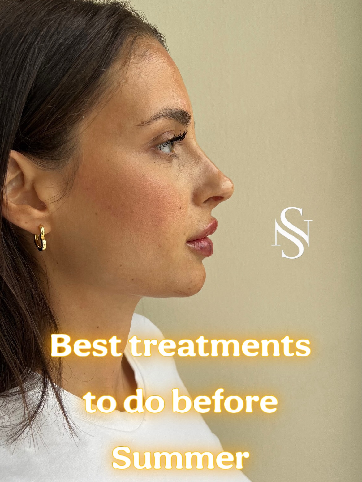 If you want glowing skin for summer, now is the time to start. ☀️
Skin treatments need time to stimulate collagen, hydrate the skin, and improve texture, so planning them a few months before summer gives the best results.
My go-to treatments for a natural glow:
✨ PRP – skin regeneration
✨ Profhilo – deep hydration
✨ Microneedling – collagen stimulation
✨ PRX-T33 – brighter, smoother skin
Start early for the best results before summer.
📩 DM to ask more or book a consultation via the link in bio
#prx #summer #skinhealth #fypageシ゚