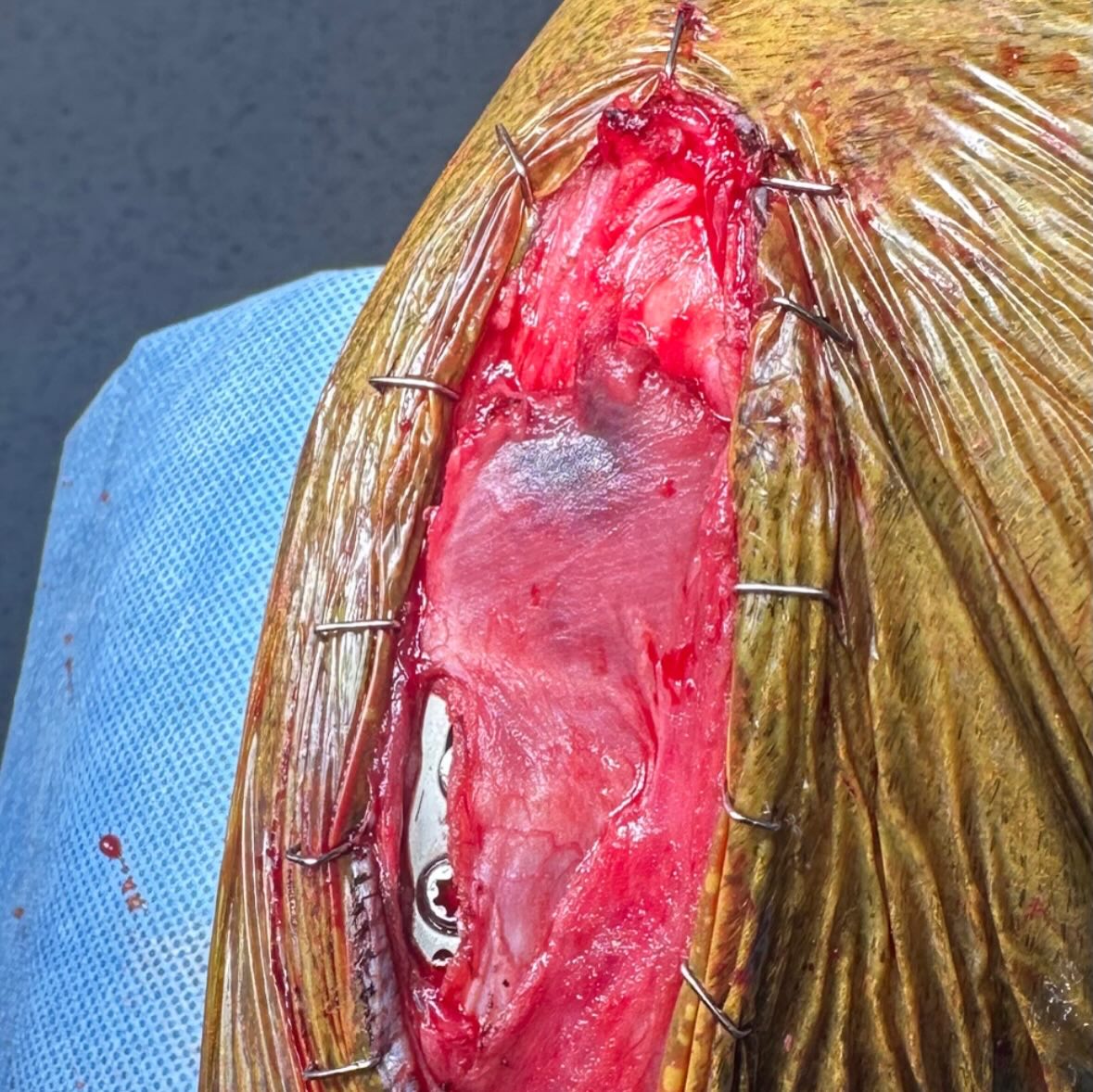 photo 1. prior to close (with post-op xray overlay in photo 2). tplo performed with pes sparing approach. reported improved early function in similar human surgeries. video full weight-bearing 1 day after surgery