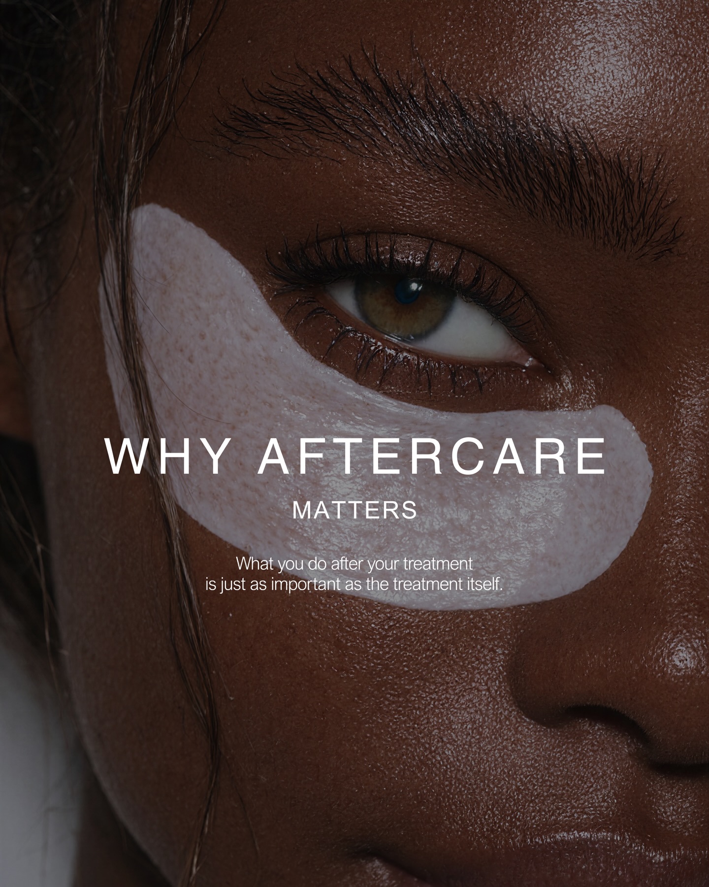 Why Aftercare Matters
After every treatment, we provide clear aftercare instructions to help protect your results and support the best possible outcome.
Following the correct aftercare helps to:
• Reduce swelling and bruising
• Allow the product to settle correctly
• Lower the risk of complications
• Protect the longevity of your treatment
Aesthetic treatments don’t end when you leave the clinic — the first 24–48 hours are an important part of the healing process.
Taking a few simple precautions during this time helps ensure your results heal smoothly and look their best.
If you ever have any questions after your appointment, we are always here to help.
www.ceteaesthetics.co.uk