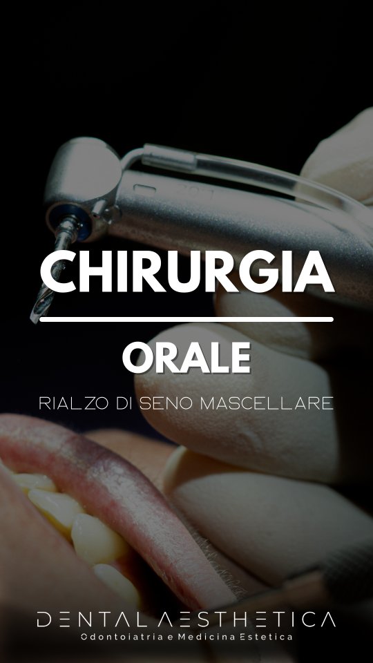 ⚠️ Contenuti sensibili - intervento di chirurgia orale per il rialzo di seno mascellare
Situazione di scarsità ossea gestita con un intervento per innesto di materiale biocompatibile, in preparazione ad un futuro intervento di chirurgia implantare.
✨️ Dental Aesthetica- Odontoiatria e Medicina Estetica
👨🏻⚕️ @mattia.todaro
📍 viale della Grande Muraglia 256
📱 375 88 47 069