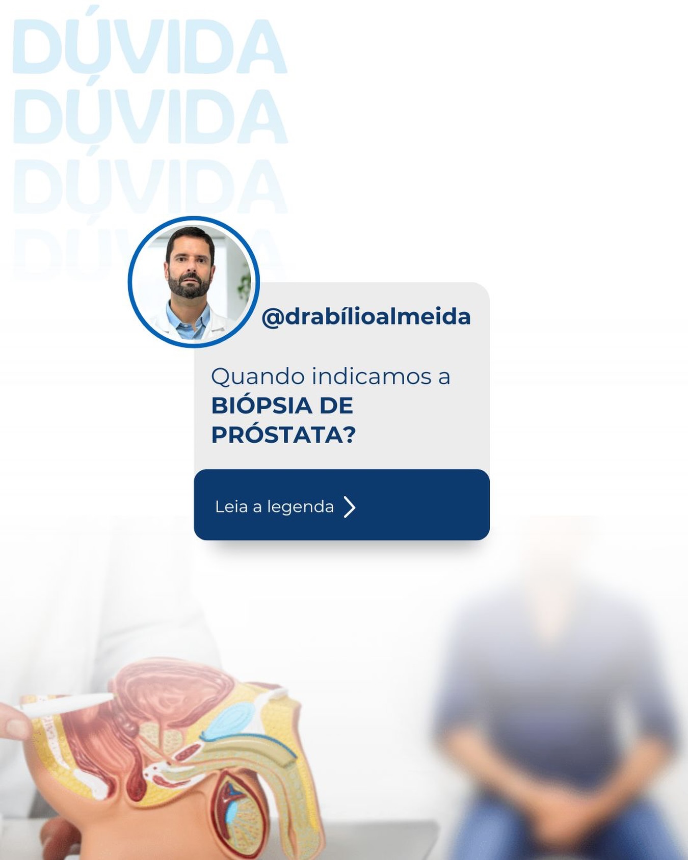 Essa é uma das perguntas mais comuns no consultório de urologia — e entender isso pode ajudar você a cuidar melhor da sua saúde.
A biópsia de próstata é indicada principalmente quando há suspeita de câncer de próstata. Essa suspeita pode surgir em algumas situações:
🔎 PSA elevado
O aumento do PSA (Antígeno Prostático Específico) no exame de sangue pode indicar a necessidade de investigação mais detalhada.
✋ Alteração no toque retal
Nódulos, áreas endurecidas ou irregularidades na próstata durante o exame físico podem justificar a biópsia.
🧲 Alterações na ressonância magnética da próstata
Quando a ressonância identifica lesões suspeitas, especialmente classificadas como PI-RADS 3, 4 ou 5, a biópsia pode ser recomendada.
📈 Aumento progressivo do PSA ao longo do tempo
Mesmo que o valor não esteja muito alto, a elevação contínua pode ser um sinal de alerta.
Importante:
A decisão de realizar a biópsia é individualizada. Avaliamos idade, histórico familiar, exames anteriores e condições clínicas do paciente antes de indicar o procedimento.
📍 Agende sua avaliação e cuide-se.
#Urologia #SaúdeMasculina #CâncerDePróstata #Prevenção