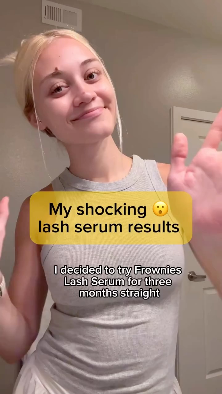 The results from our Lash & Brow serum will blow you away!
Our serum is made with peptides and without prostaglandin (meaning they won’t change your eye color or any funky stuff like that).
Our customer results are so good we wanted everyone to get their hands on this!
#lashserum #browserum #lashgrowth #frowniescanada #lashes