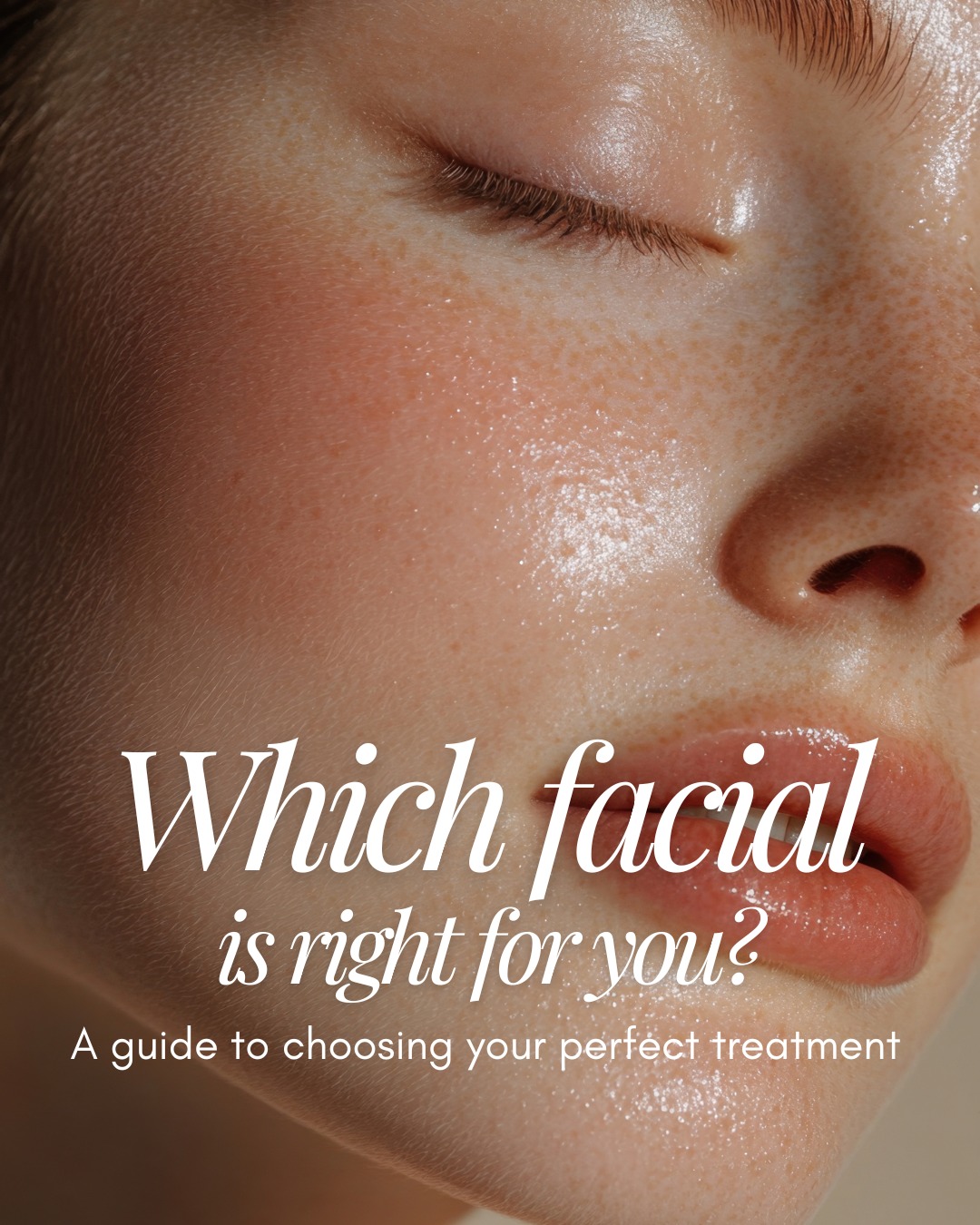 Your skin deserves more than a one-size-fits-all approach ✨
At House of Muse, every facial is designed to restore, refine and reveal your glow - whether you need hydration, clarity, radiance or sculpting.
Explore our facial menu and find the treatment that fits your skin best. Book your appointment now via the link in our bio 💖