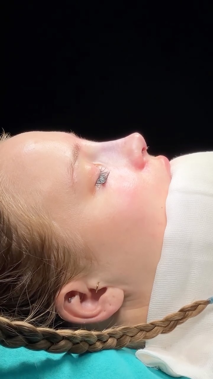 High radix, high bridge.
⭐️⭐️⭐️
From 🇦🇺