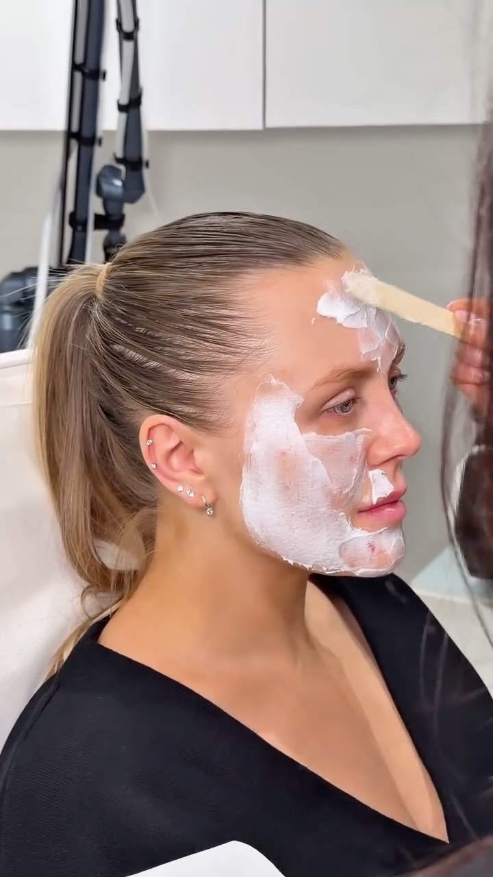 First CO2 laser treatment for my client ✨
Today we started her skin transformation journey with a CO2 laser resurfacing treatment, one of the most in-demand and results-driven treatments in advanced aesthetics.
Why it’s such a popular treatment:
✨ Boosts natural collagen production
✨ Softens fine lines & wrinkles
✨ Improves acne scars & texture
✨ Refines enlarged pores
✨ Reduces pigmentation & sun damage
✨ Smooths uneven skin tone
✨ Tightens and firms the skin
✨ Delivers long-lasting, transformative results
CO2 laser works by creating controlled micro-channels in the skin to stimulate deep repair and regeneration. Over the next several weeks, new collagen forms, revealing smoother, clearer, firmer skin.
We’ll be documenting her healing journey day by day so you can see the real recovery process and the beautiful results as they unfold. Stay tuned for the transformation ✨