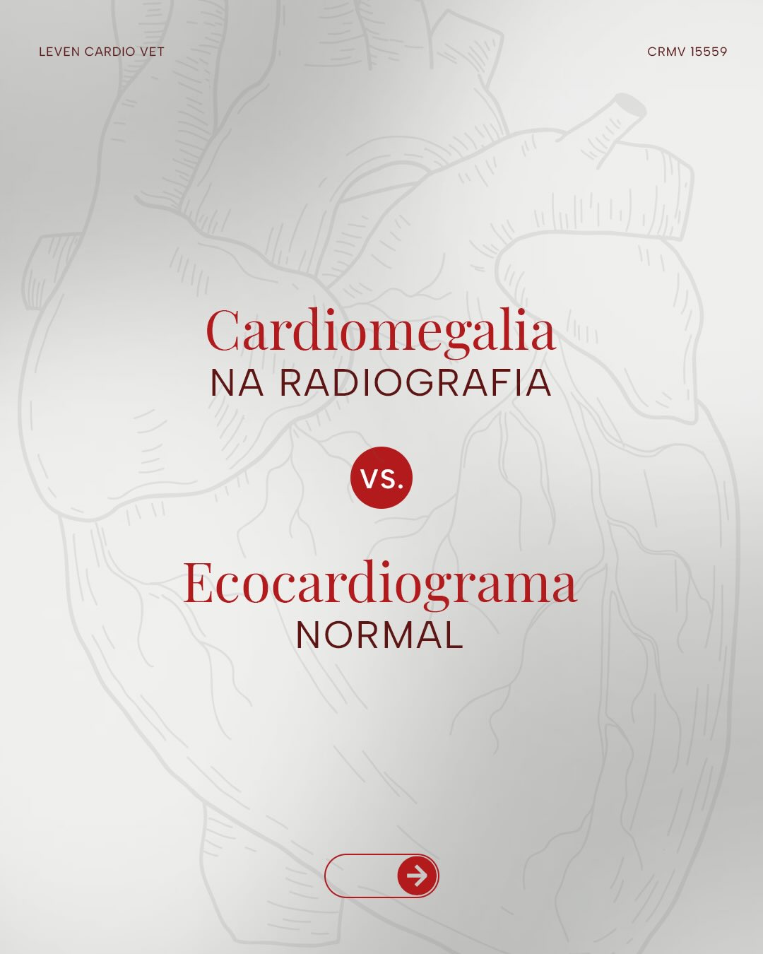 Cardiomegalia na radiografia não confirma cardiopatia.
A radiografia torácica é um exame de triagem extremamente importante, tanto como ponto de partida quanto, em muitos casos, como parte do diagnóstico. Ela avalia diversas estruturas do tórax, incluindo a silhueta cardíaca.
No entanto, o tamanho do coração pode parecer aumentado por influência de vários fatores.
Por isso, apesar de ser fundamental, muitas vezes a radiografia precisa ser complementada, ela nem sempre é o exame final.
O ecocardiograma é o padrão ouro para avaliar cardiomegalia e cardiopatias. Ele permite analisar estrutura e função cardíaca com precisão.
Pode haver aumento na radiografia com ecocardiograma normal. E também alterações no ecocardiograma que não aparecem na radiografia.
Na suspeita de doença cardíaca, a avaliação cardiológica completa é o que garante segurança no diagnóstico.
