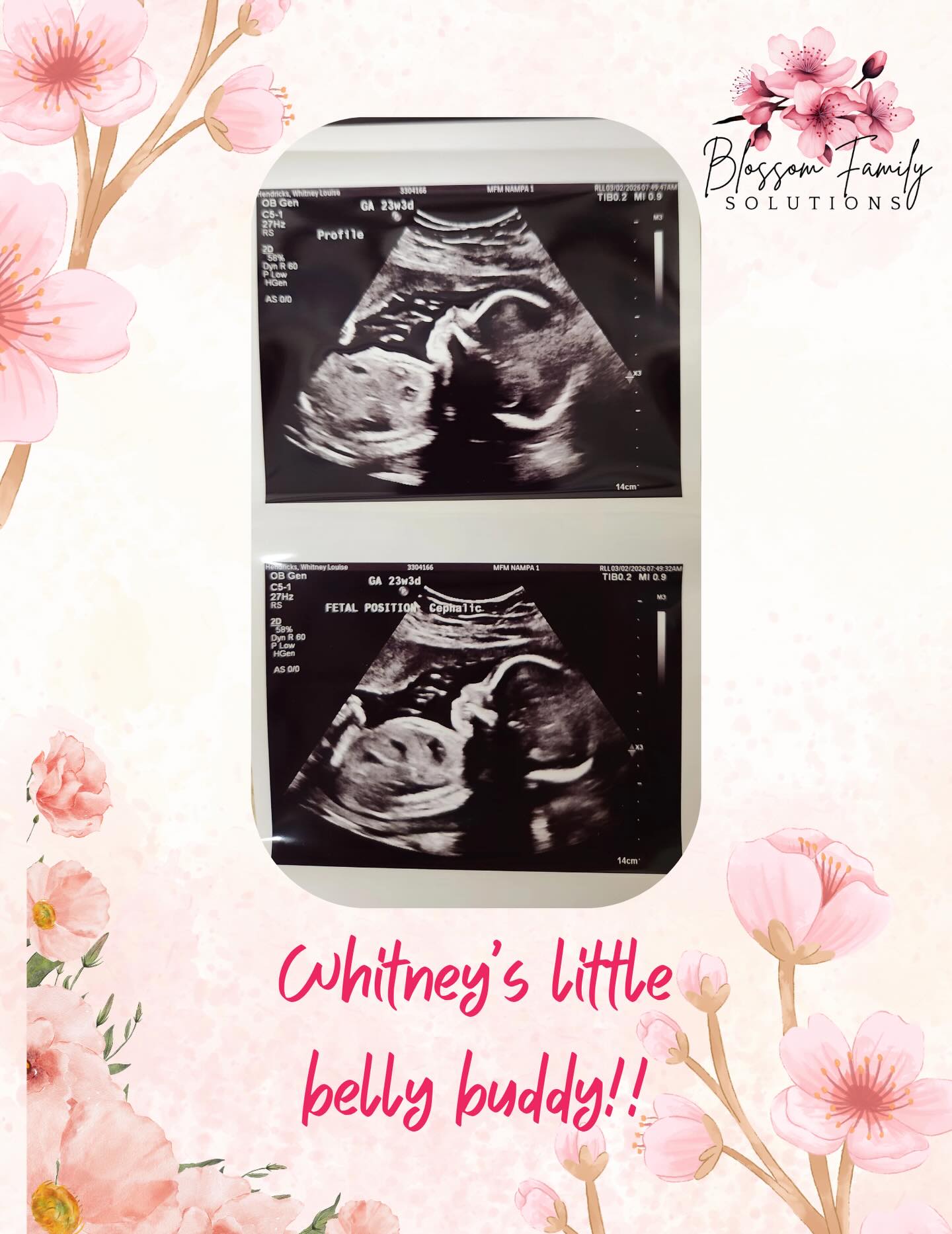 Our very own Whitney showing off her perfect little belly buddy. Hey little guy! 👋
