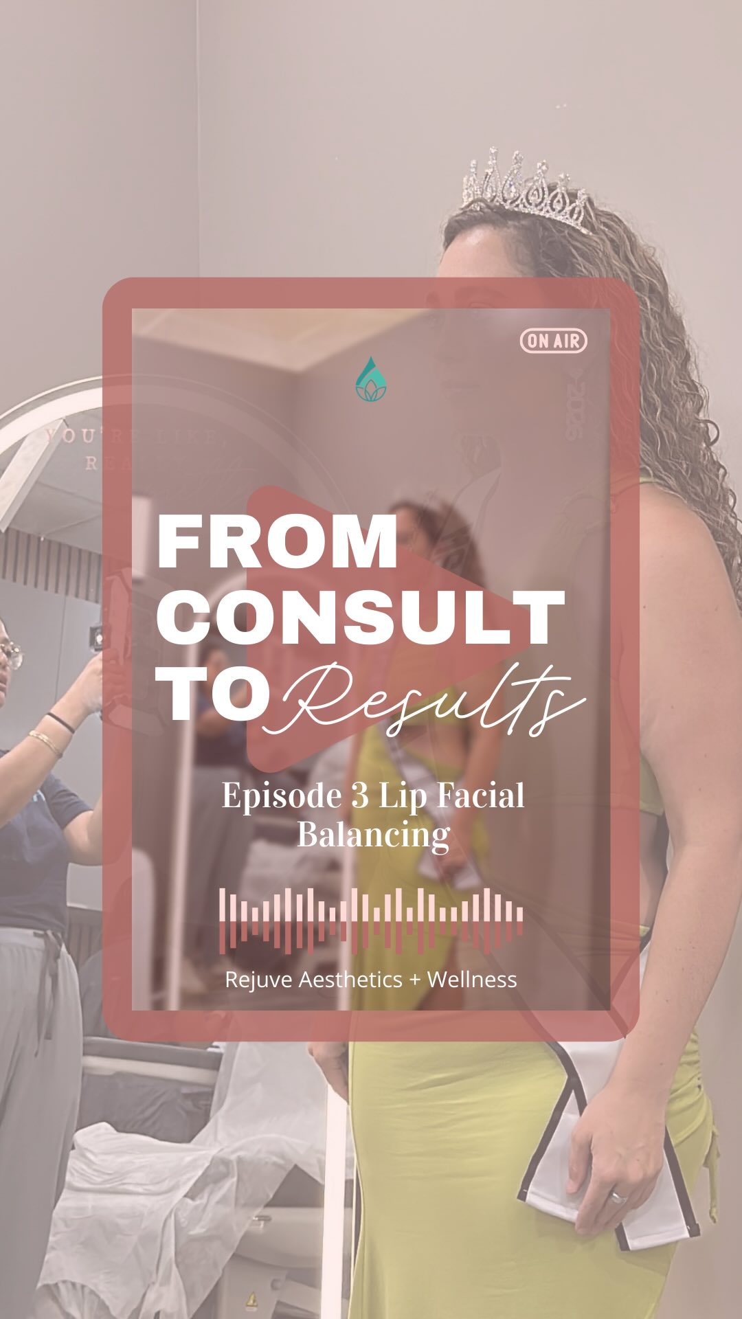 This is why we donât just âadd fillerââwe create a PLAN. â¨
Our Miss Ms. and Mrs. Hawaii contestant didnât walk in asking for one specific treatment. She came to us wanting to enhance her natural beauty, and through a proper consult, we mapped out a full facial balancing journey:
đš Started with neurotoxin (forehead + crowâs feet + lower face)
đš Lip balancing for natural volume + hydration
đš Chin enhancement to support her new lip proportions
đš Subcision + filler to address volume loss and soften emerging lines
Hereâs what most people miss:
đŠââď¸ Facial balancing isnât a single appointment. Itâs a strategic process where each treatment supports the others to enhance your unique features.
When you understand your facial anatomy and have a practitioner who sees the full picture, you get results that look like YOU, just elevated.
Wishing our gorgeous client all the luck at her competition! đ
đ Follow for next weeks episode of Consult to Resultâwhere we break down why timing of your laser treatments matters more than you think.
#ConsultToResult #facialbalancing #aestheticseducation #medicalaesthetics honolulumedspa rejuvewellness facialanatomyeducation beforeandafter