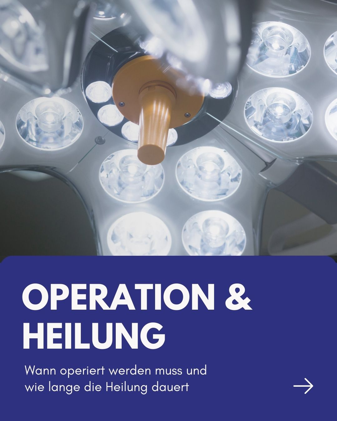 ⏳ Heilung braucht Zeit – egal ob mit oder ohne OP.
Eine gute konservative Therapie (Physiotherapie) kann sich über Monate strecken - Schritt für Schritt.
Nach Eingriffen:
• klein: ca. 2–3 Wochen
• größer: 2–6 Wochen + Reha & Physio
Entscheidend ist nicht der Weg, sondern das Ziel: ein stabiles, belastbares Knie.