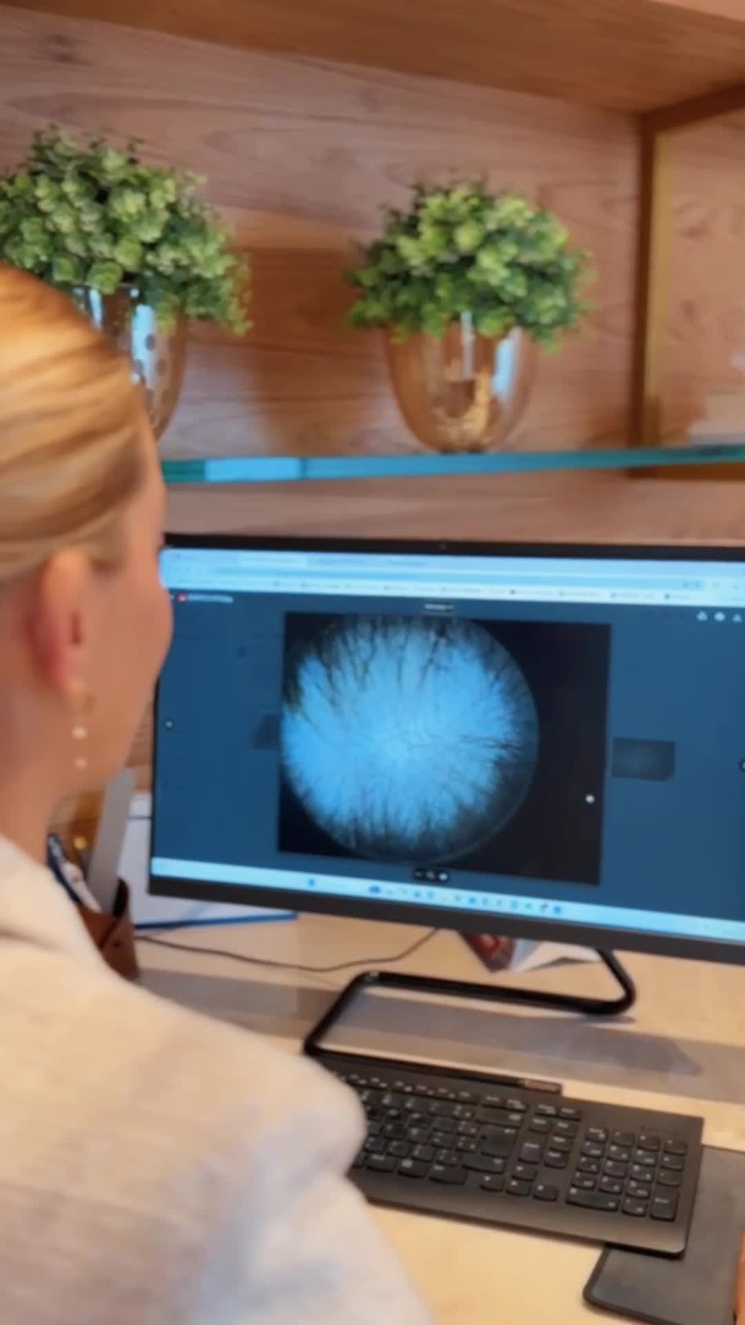 Muita gente abandona o tratamento capilar porque acha que não está funcionando.
Mas caaaalma! 🤭 O cabelo não muda da noite pro dia. O ciclo é lento e os resultados vêm com constância e ajuste.
Se você quer começar a tratar sua queda capilar, guarde isso: você precisa de um diagnóstico correto, confiar no seu médico e de paciência.
➖
Dra. Julyanna do Valle
Médica Dermatologista
CRM GO 16116 | RQE 10437
📱 (62) 99233-5473
📍 Órion Complex, sala C3407