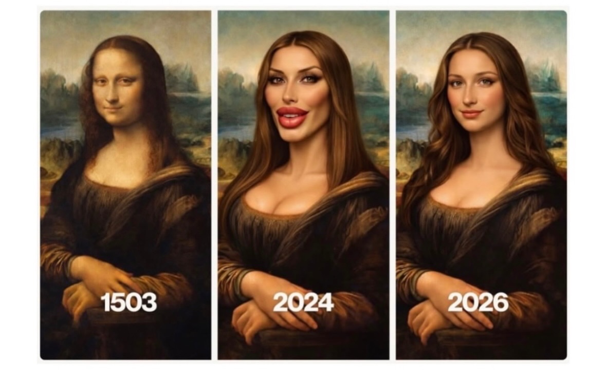 From original…
To overdone…
To 2026 ✨
Aesthetics has evolved — and thankfully, so has the mindset.
There was a time when “more” was mistaken for “better.”
Overfilled. Overfrozen. Overdone.
But the future of aesthetics?
It’s refined.
It’s balanced.
It’s undetectable.
The goal has never been to change the face.
It’s to respect it.
As a medical practitioner, my approach has always been about enhancing — not altering. Preserving movement. Maintaining proportion. Supporting the natural anatomy.
Because the best aesthetic work isn’t obvious…
It just looks like you — on your best day.
Natural will always be timeless 🤍
#NaturalEnhancement #AestheticMedicine #SubtleNotSudden #TimelessBeauty #BeautifulAesthetics