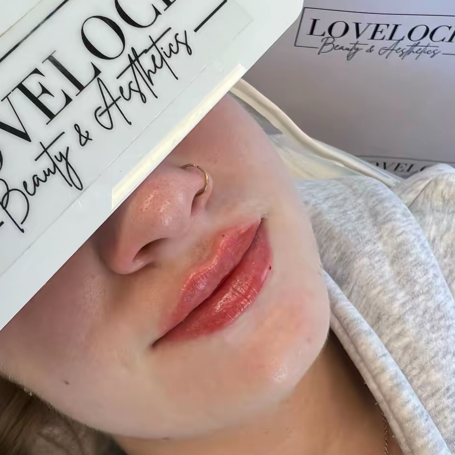 Lip filler can look natural! ❤️
📍 Warminster 📍 Romsey
Level 7 expert practitioner
#warminster #westbury #trowbridge #frome #melksham