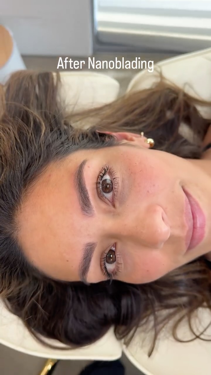Our gorgeous client looks even more radiant with perfectly defined and filled-in eyebrows. It’s the little details that make all the difference! 💖
#naturalbeauty #nanoblading #perfectbrows