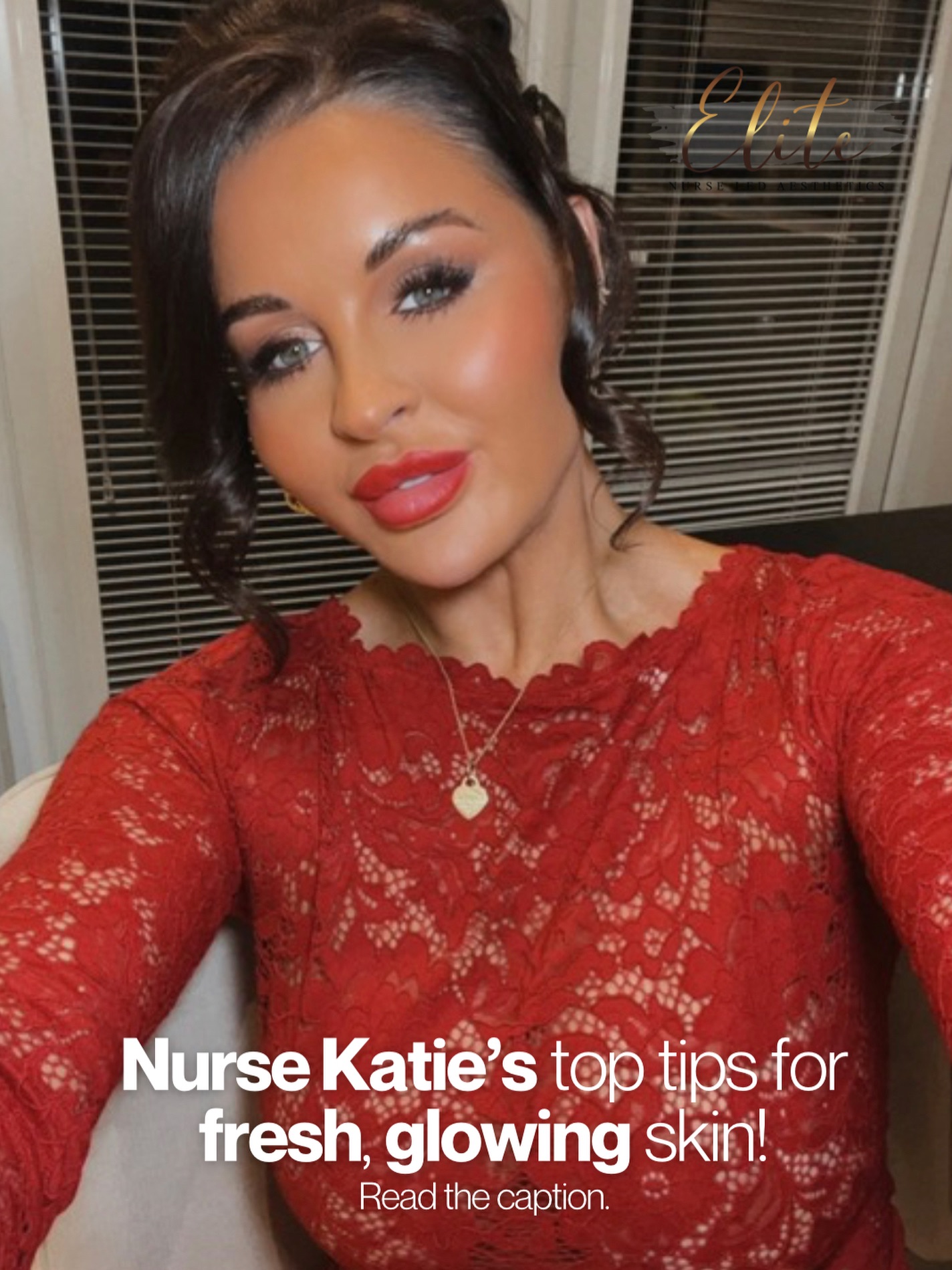 ✨ Nurse Katie’s Top Tips for Fresh, Glowing Skin ✨
Healthy, radiant skin isn’t about one treatment – it’s about the right combination 👇
💉 Dermapen Microneedling
Stimulates collagen, smooths texture, and boosts glow from within. Perfect for dull, tired skin.
🧪 Regular Chemical Peels & Dermaplaning
Exfoliate, refine pores, and remove dead skin for instant brightness and better product absorption.
💧 3D Hydrofacials with RF Skin Tightening
Deep cleanse, hydrate, and tighten in one treatment – glow and lift ✨
🧴 ZO Skin Health – Medical Grade Skincare
Results-driven home care is key. Professional products = professional results. Consistency matters!
💦 Skin Boosters & Polynucleotides
Deep hydration, improved elasticity, and long-term skin regeneration for that fresh, plump glow.
💬 Great skin is a journey, not a quick fix. Let Nurse Katie create a personalised skin plan just for you.
📍 Batley, West Yorkshire
📩 DM us to book your consultation or to start your glow-up ✨