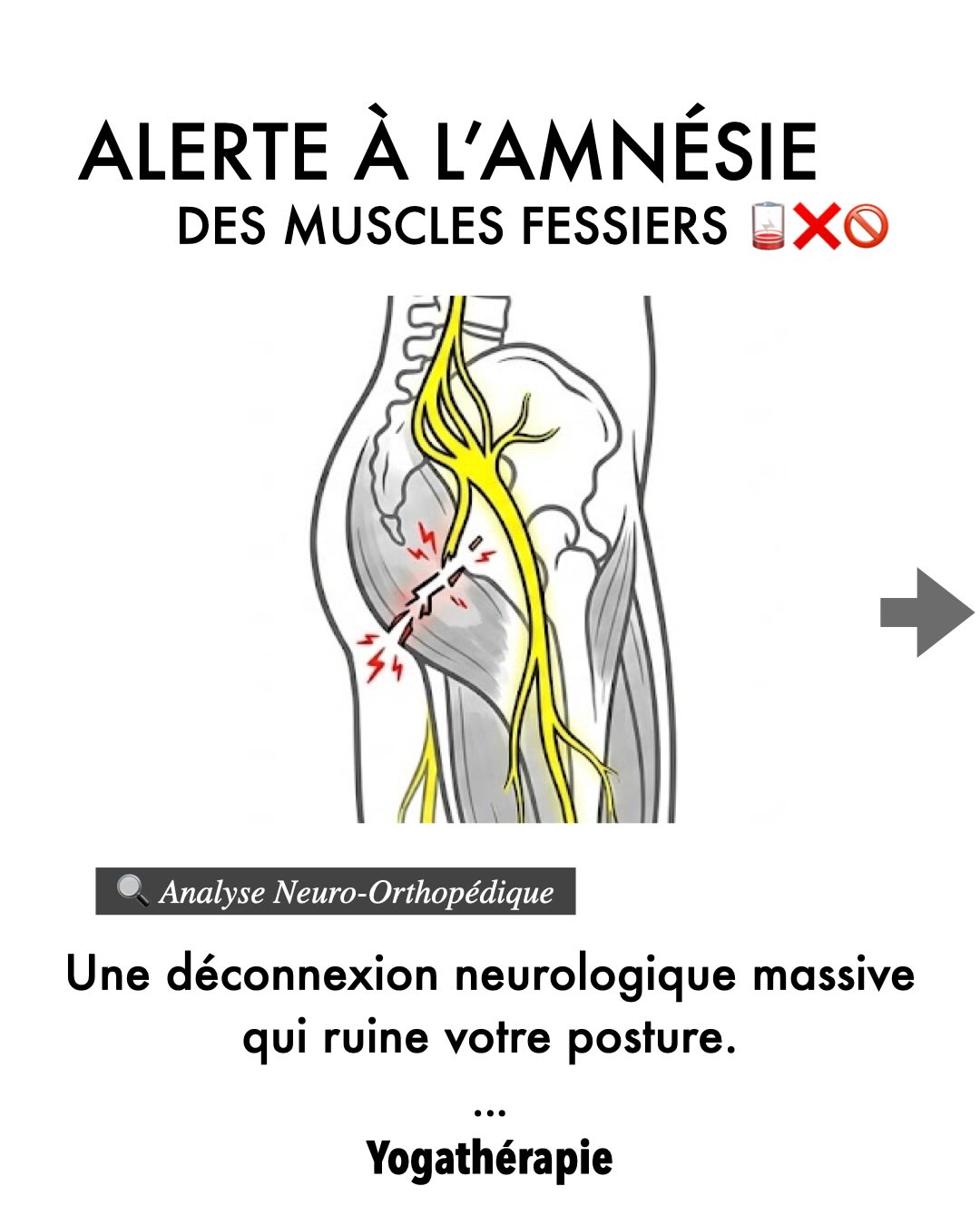 Le New York Times a sonné l’alerte :
vos fessiers sont-ils « amnésiques » ? 🔌💀
Ce n’est pas seulement une question d’esthétique, c’est un problème de santé publique qui cause maux de dos, de genoux et sciatalgies.
En restant « mal assis », vous affaiblissez vos muscles fessiers parmi les plus puissants du corps.
Nous avons conçu un outil pour vous aider à comprendre cette hibernation musculaire.
Ce que vous allez découvrir dans ce guide:
✅ L’éducation posturale :
Pourquoi la manière de s’asseoir change tout.
✅ La séance dédiée :
De la flexion de hanches sur chaise aux postures de force comme le Guerrier 3.
✅ La respiration active :
Comment l’expiration transforme votre engagement profond.
✅ Accompagnement :
Une séquence de 7 mails exclusifs pour intégrer ces conseils dans votre quotidien.
Arrêtez de supporter passivement le poids de votre corps, remettez vos muscles en mouvement !
Comment recevoir le guide ?
👇 Commentez simplement « GO » sous ce post.
Je vous envoie le lien par message privé pour que vous puissiez télécharger votre exemplaire ennemi PDF.
Prêt à réveiller votre moteur arrière ? 🐊🏛️
#amnesiefessiere #fessiersmorts #cathetsergeyoga #yogatherapie #posturo