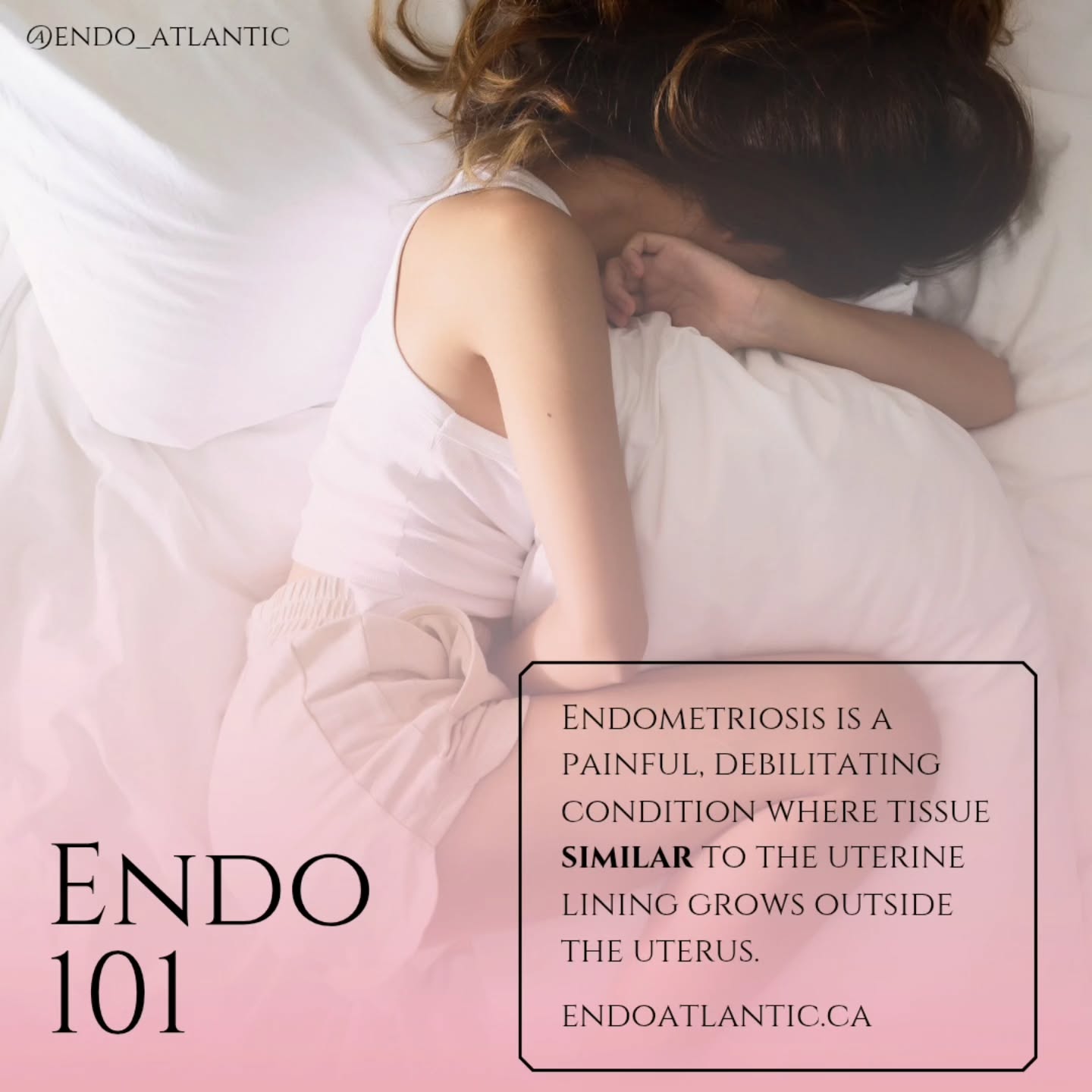 Welcome to Endo 101: The Basics. Because when something affects at least 1 in 10 people and still takes nearly a DECADE to diagnose, repetition is necessary! 👏
Now you know the basics!!
#EndometriosisAwareness #endoatlantic #endofacts #endometriosis #endoawareness