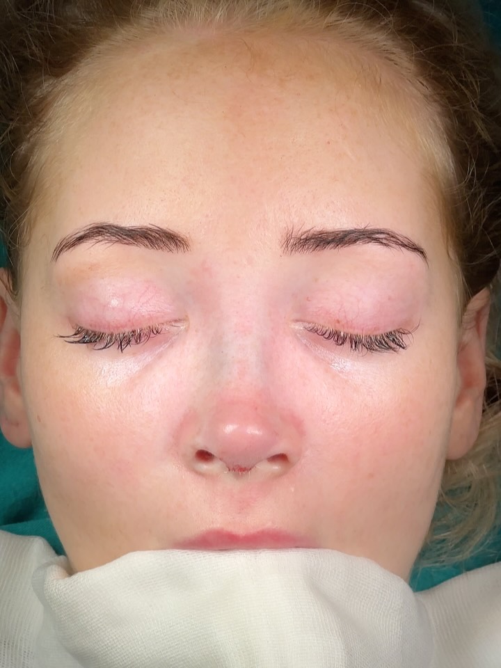 Reduction⭐️⭐️⭐️
From🇩🇪