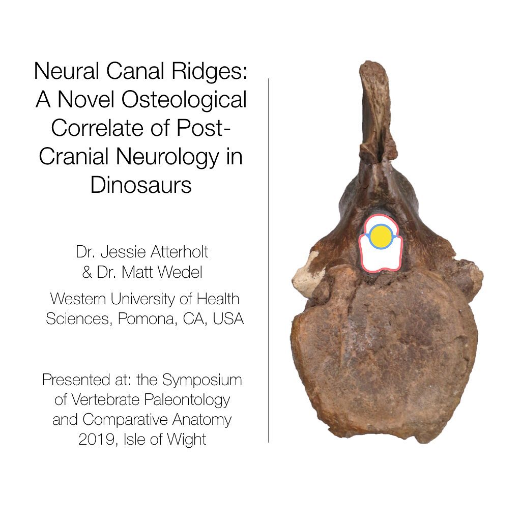Last week I had the immense pleasure of attending the 67th Symposium of Vertebrate Paleontology and Comparative Anatomy. I gave a talk on some of my recent research, and thought it would be fun to also āpresentā my talk to a larger audience on Instagram.
.
So here we go! This is Part 1 of Atterholt and Wedel, SVPCA 2019.
.
The title of the talk mentions āosteological correlates,ā meaning structures on bone that give us clues about soft tissue anatomy. In this case, we found bony things that tell us about neuroanatomy in dinosaurs...but weāll get to that!
.
Matt and I have noticed and documented bony ridges in the vertebral (neural) canals of many sauropod (long neck) dinosaurs. This is the space where the spinal cord sits. We only find them in the caudal (tail) vertebrae.
.
They are very tiny and easy to overlook, but once you get the search image very easy to spot! We noticed that they are elongate from the front to back of the vertebra, but donāt extend all the way to the ends of the vertebral canal. They also are variable in size and position in the canal. .
So far, we have found these odd neural canal ridges in every neosauropod weāve looked in! So theyāre present in a great diversity of long-necked dinosaurs.
.
The question then is: what are these?? Stay tuned for further posts on the various ideas we considered, and our final conclusion!
.
#dinosaursofinstagram #dinosaur #research #svpca2019 #sauropod #vertebra #anatomy #paleontology @mathew.wedel
