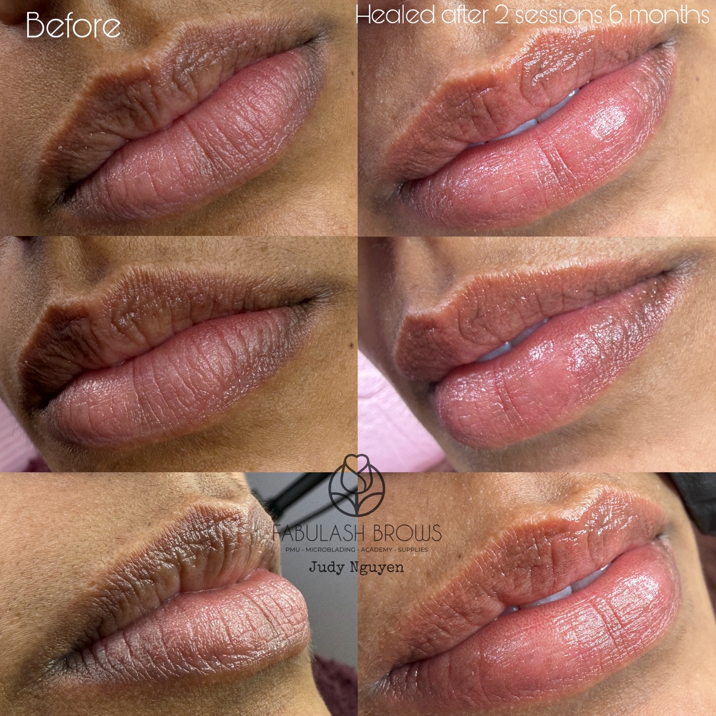 💁♀️Dark Lip Neutralisation after 6 months, 1 more session to go then she will get beautiful lips !!!💯
#liptattoo #darklipcorrection #cosmetictattoo #tattooedlips #blushliptattoo