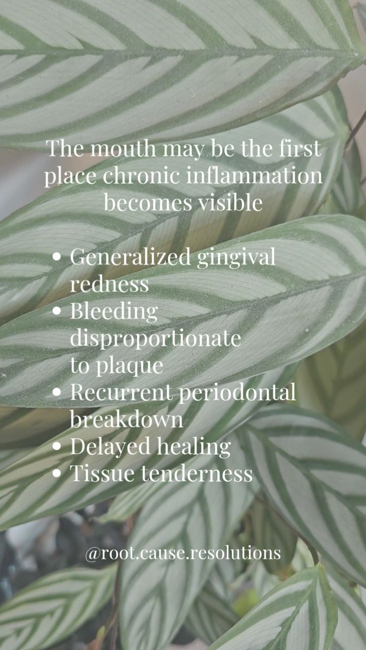 The mouth may be the first place chronic inflammation becomes visible, even before labs flag it, before a formal diagnosis, before the patient realizes something systemic is brewing.
Look closely at what the tissues are telling you
➡️ Generalized gingival erythema
➡️ Bleeding disproportionate to biofilm load
➡️ Periodontal breakdown despite appropriate therapy
➡️ Delayed post-treatment healing
➡️ Persistent tissue tenderness
⚠️ Some patients are not resistant to treatment. They are inflamed beyond the oral environment.
The question isn’t just “How do we treat the gums?” It’s “What upstream drivers are sustaining this inflammatory burden?”
🦷 This is where dentistry shifts from reactive to integrative risk assessment.
#dentistry #airwaymanagement #tonguetie #sleep #rdh