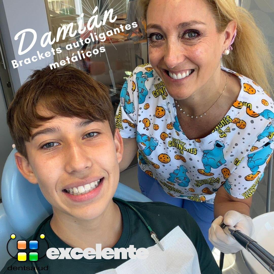🎉 Primera alta de marzo!
Paciente listo para comenzar su año escolar sin brackets y con una sonrisa nueva 😁✨
¡Nada mejor que empezar el año con confianza!
📅 Que no se te pase otro año más pensando en tu sonrisa.
Este puede ser el momento perfecto para comenzar tu tratamiento de ortodoncia.
📍 Te esperamos en Dentsalud Ortodoncia
7 Norte 645, Of. 514 – Edificio Centro Libertad, Viña del Mar
📲 Agenda tu evaluación
+56 9 9495 9758
#Ortodoncia #SonrisaNueva #AltaDeOrtodoncia #Dentsalud #ViñadelMar