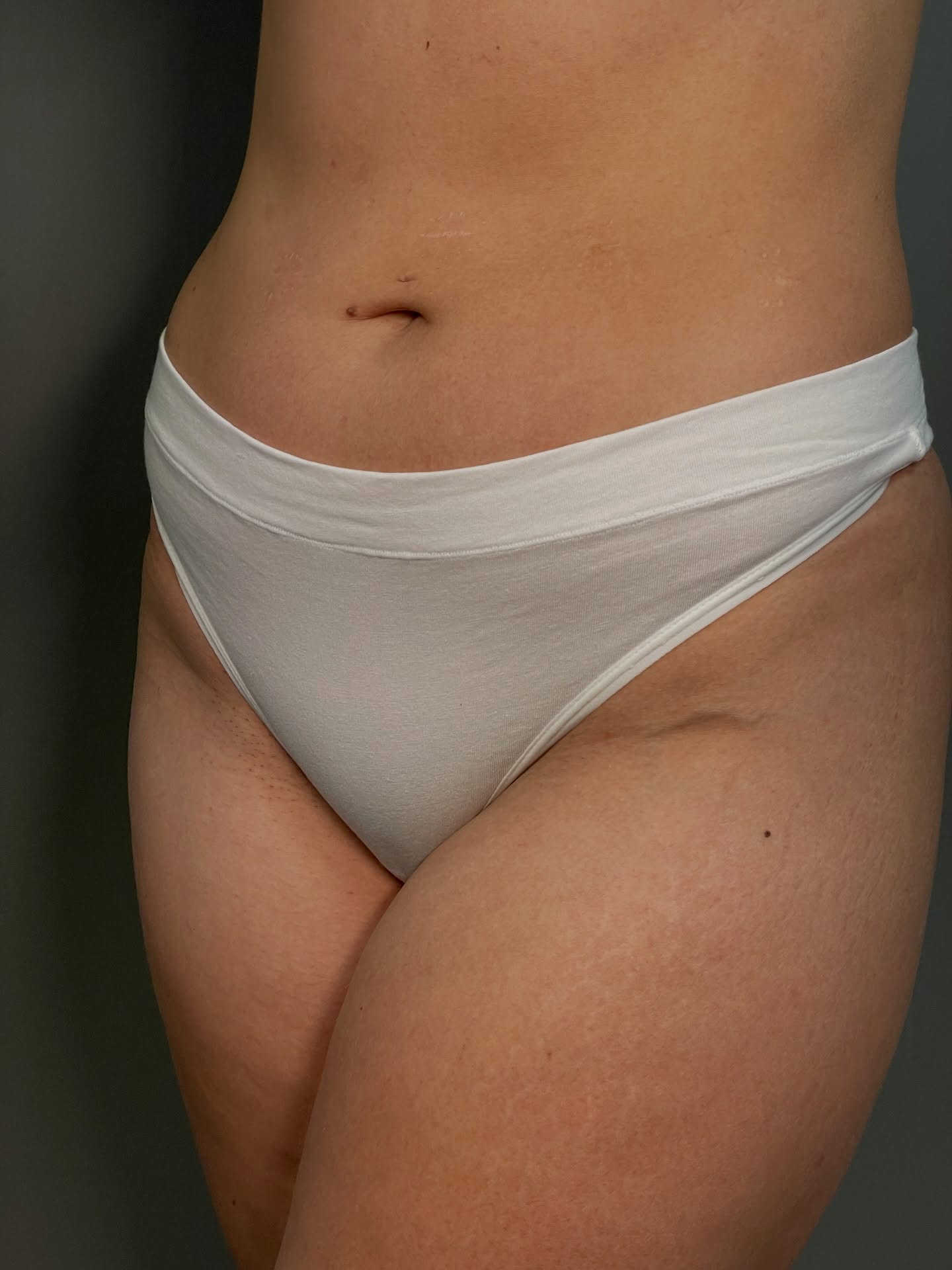 Nå får du regelmessig brasiliansk voksing til kun 499,-/mnd 💫 Vi anbefaler å starte nå for å komme i god rutine før sommeren ☺️
Kjøp medlemskap på www.skinsation.no 👙 da får du i tillegg 20% rabatt på all annen voksing 🥳
