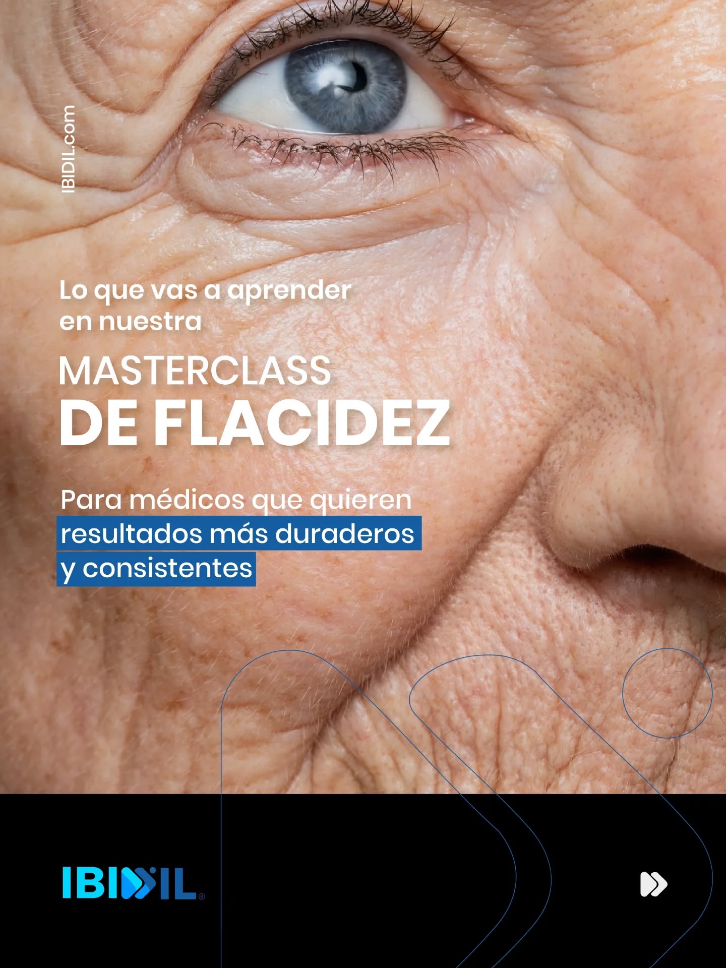 La flacidez es uno de esos temas que en consulta se repiten una y otra vez.
No solo porque preocupa a muchos pacientes, sino porque para nosotros como médicos, el reto real es lograr **resultados duraderos y consistentes**.
Y seamos honestos: muchas veces el problema no es “la técnica”.
El problema es que tratamos la flacidez como si fuera un solo diagnóstico, cuando puede estar dominada por distintos mecanismos en cada paciente.
Por eso creamos esta masterclass para médicos:
“Flacidez Cutánea: Mecanismos moleculares y su reparación con infiltración de bioestimuladores.”
En esta clase vamos a ayudarte a:
- Entender qué está pasando en el tejido cuando aparece la flacidez
- Evaluar con más criterio para indicar con más precisión
- Usar bioestimuladores infiltrados de manera racional, con objetivos claros
- Mejorar la lógica clínica de tus planes para elevar resultados y satisfacción del paciente
📅 10 de marzo
🕗 8:00 pm a 9:30 pm
💻 Online vía Zoom
🎟 Inversión: Ref 25
Incluye ebook exclusivo de la masterclass como material de apoyo.
Comenta **FLACIDEZ** y te enviamos toda la información para inscribirte.