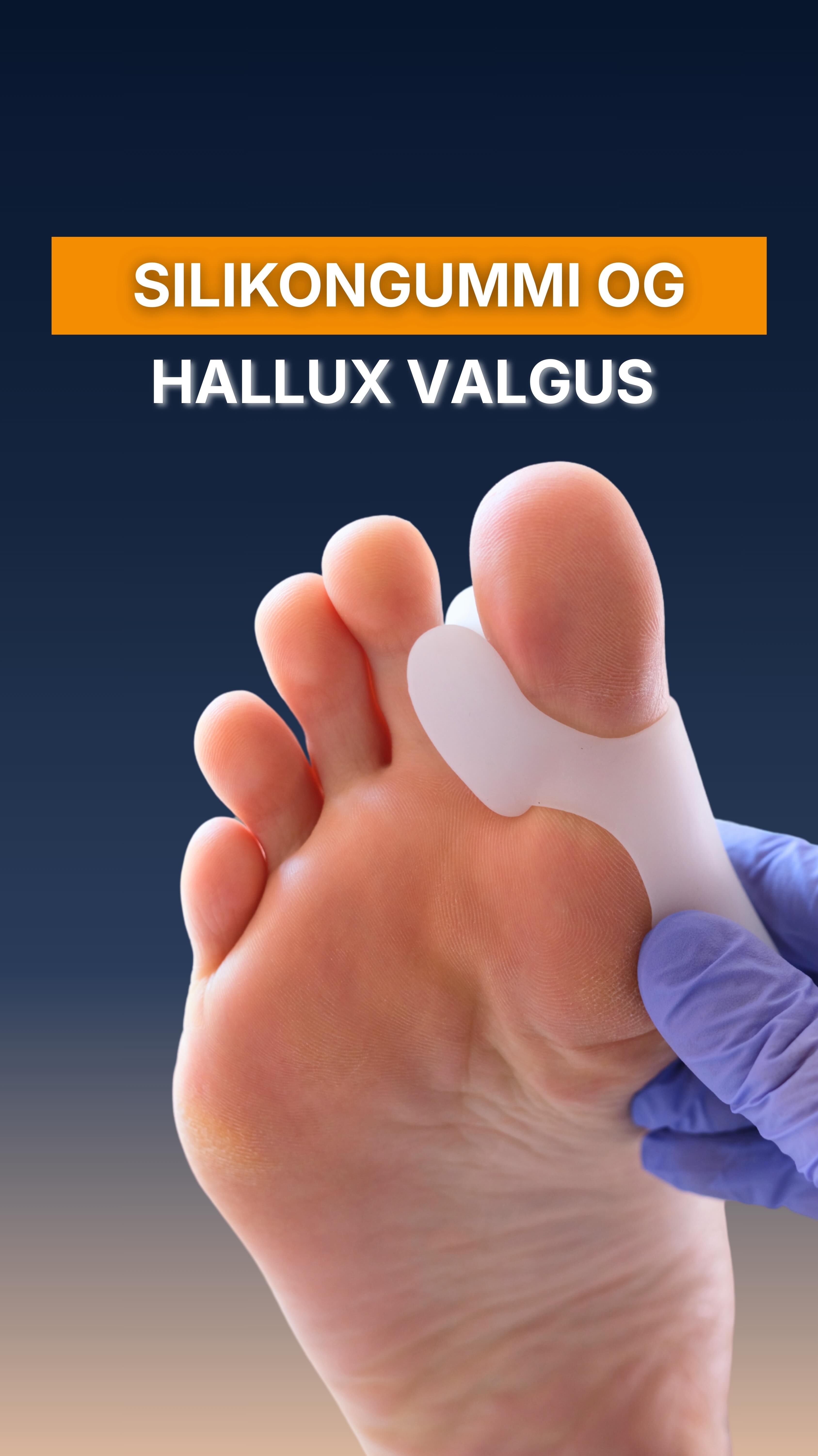 Silikongummi vil aldri rette tåene dine, men det vil dempe symptomene. Har du prøvd det før? 🦶