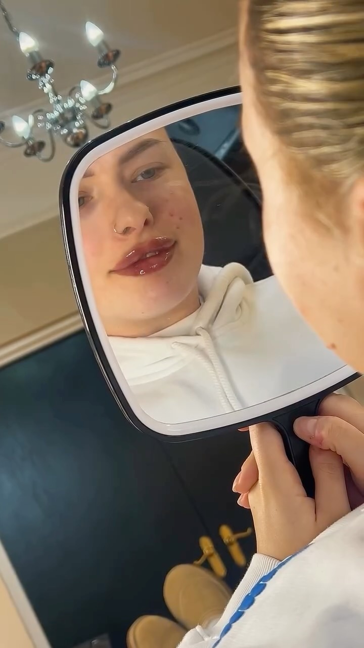 A little filler, a lot of confidence 💋
Results speak for themselves 💉
#lipfiller #aesthetics #aestheticspractitioner #sunderland #sunderlandaesthetics