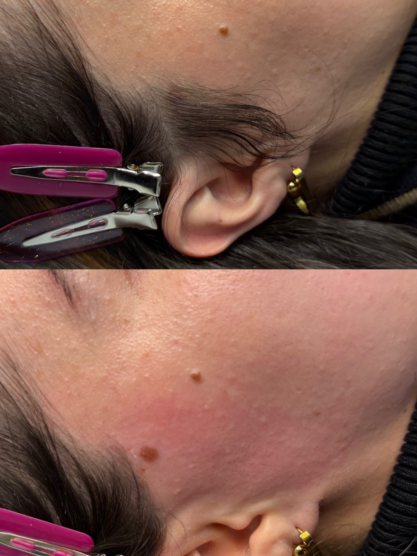 Sideburn wax!
Stop shaving unwanted hairs on your face. Start waxing and leave your skin smoother with finer, slower regrowth.
#waxing #facialwaxing #sideburns #esthetician #massachussets