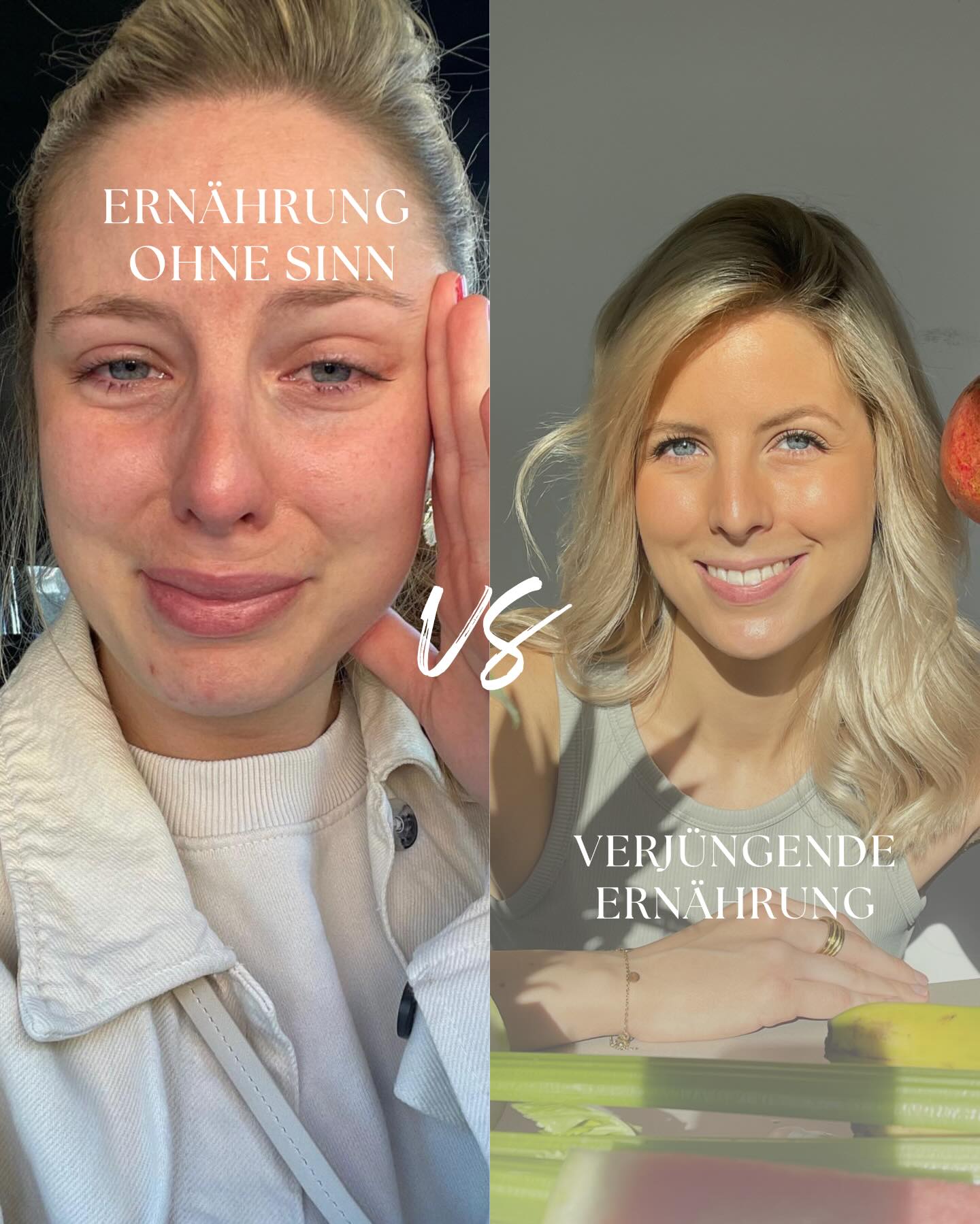 Ja, wir werden alle älter.
Aber die eigentliche Frage ist: Wie und wie schnell?
Mit Ende 20 zog ich eine ehrliche Bilanz:
🚫 Reizdarm
🚫 ständiger Blähbauch
🚫 chronische Entzündungen
🚫 ständig krank
🚫 aufgequollenes Gesicht
🚫 delliger Körper
🚫 keine Ausdauer
🚫 Periodenschmerzen zum Umfallen
🚫 Allergien & Unverträglichkeiten
🚫 immer mehr mimikbedingte Falten
Die Liste war noch länger…
Dabei wollte ich eigentlich etwas ganz anderes:
🌸 Keine Falten, aber auch kein Botox
🌸 Falten glätten und natürlich vorbeugen
🌸 Mich endlich im Bikini wohlfühlen
🌸 Reine Haut
🌸 Von innen strahlen
🌸 Einen flachen Bauch mit guter Verdauung
🌸 Und irgendwann eine fitte, strahlende MILF sein
Also begann ich, an den richtigen Hebeln zu drehen.
Ich bildete mich weiter.
Las aktuelle Studien aus der Longevity- und Biohacking-Forschung.
Begann, mich genbasiert zu ernähren und meinen Körper gezielt mit den Nährstoffen zu versorgen, die er wirklich braucht.
Was ist passiert?
😊 Gesunde Ernährung ist für mich keine Phase mehr.
💡 Ein verjüngender Lebensstil ist kein Wochenendprojekt.
🫱🏼🫲🏻 Es ist mein Alltag geworden.
Und meine „Ich-wollte-eigentlich-Liste“ ist heute Realität.
Und das Wichtigste:
Damit bist du nicht alleine.
Ja, es ist möglich, dein biologisches Alter positiv zu beeinflussen
wenn du deinem Körper endlich das gibst, was er wirklich braucht.
💡 Ein einfacher Start kann ein 21-Tage Cleanse sein:
mit verjüngenden, nährstoffreichen Rezepten, sanfter Unterstützung für Darm und Leber, Nervensystem-Regulation und persönlicher Begleitung.
Kein offenes Programm.
Kein Hin und Her.
Nur Frauen, die bereit sind, lange gesund und jung zu bleiben.
💌 Wenn du dazugehören möchtest, kommentiere SPRING 🌱 Dann schicke ich dir alle Infos
#slowaging #springcleanse #shinefromwithin #biohacking
