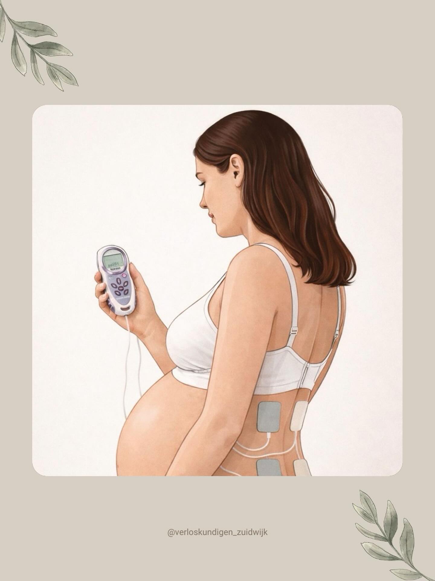 Wist je dat alle verloskundigen van onze praktijk tijdens de dienst een TENS-apparaat bij zich hebben? ✨
Een TENS kan helpen bij het verlichten van de pijn tijdens de bevalling. Als je dit wilt, kun je hier gebruik van maken.
Het apparaatje lijkt een beetje op een afstandsbediening en je houdt het zelf in je hand. Op je onderrug worden vier plakkers geplaatst naast je wervelkolom. Deze geven kleine elektrische prikkels af.
Je kunt zelf de sterkte instellen:
• Tussen de weeën voel je een lichte tinteling (burst-stand)
• Tijdens een wee druk je op de boost-knop voor extra stimulatie
De prikkels helpen de pijnprikkels te blokkeren, waardoor veel vrouwen de weeën als minder heftig ervaren. Je houdt zelf de controle over de intensiteit..
Belangrijk om te weten:
• Je mag met een TENS niet onder de douche of in bad
Heb je interesse om een TENS te gebruiken tijdens je bevalling? Bespreek dit gerust met je verloskundige tijdens de controle. 👩🏻⚕️🤗✨ #TENS #bevalling #verloskundige