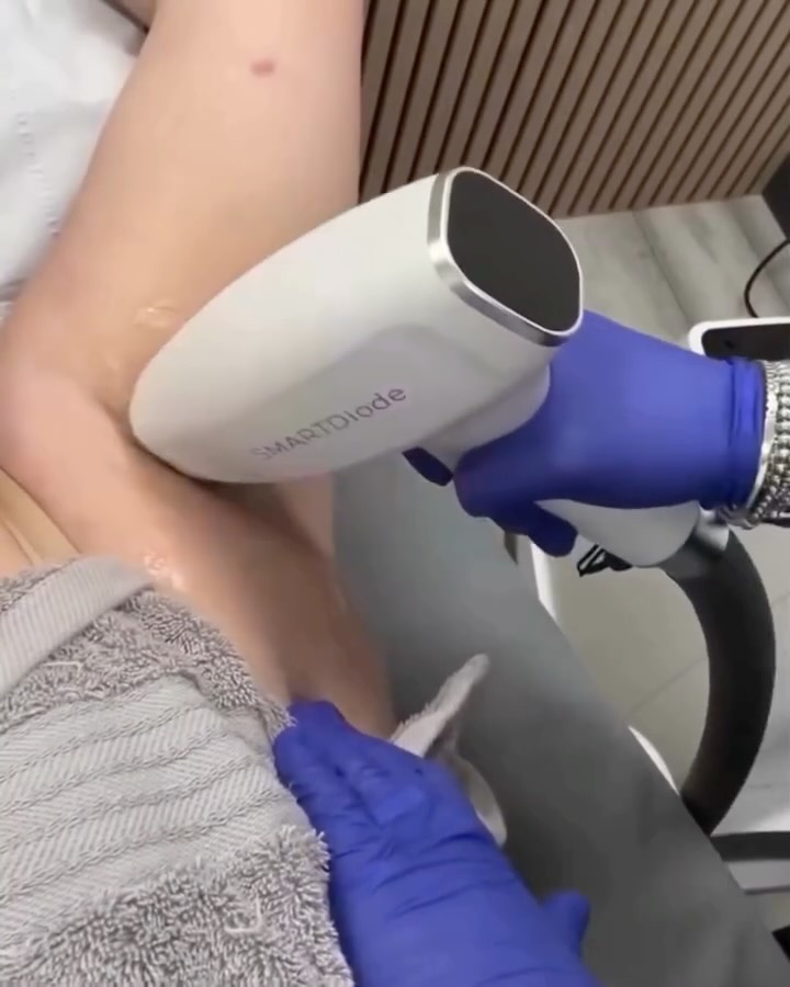 ✨ Before & After Laser Hair Removal ✨
Before: unwanted hair, constant shaving, irritation.
After: smooth, hair-free skin you can enjoy with confidence ☀️
Dreaming of hair-free skin this summer? Now is the perfect time to start your laser hair removal sessions. The sooner you begin, the better your results for summer!
👉 Start your sessions as soon as possible and get ready for smooth skin all season long 💛
#laserontharing #laserhairremoval #gladdehuid #hairfreeskin #zomerproof #voorenna #beforeandafter #ontharing #skincare #beautyclinic #smoothskin ☀