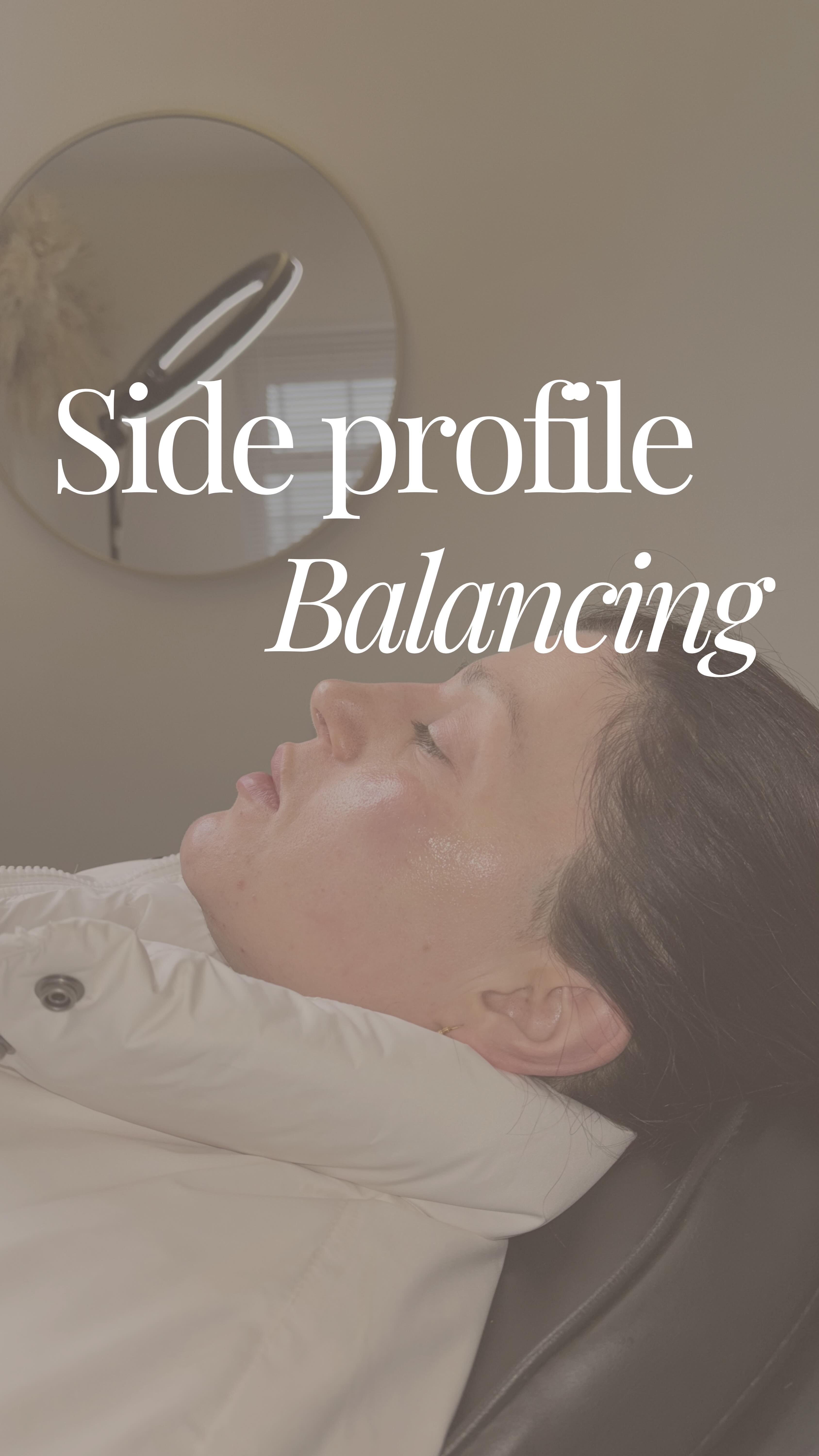 Side profile balancing focuses on creating harmony between the nose, chin and cheeks so the face flows naturally from every angle 🤍
One of the key concepts we assess in aesthetics is the ‘Ogee curve’ — the gentle S-shaped curve seen in youthful faces when viewed from the side. It starts at the cheekbone, softly dips at the mid-cheek and then curves again towards the jawline. This contour reflects healthy volume, structure and facial balance.
Over time, volume loss or genetics can flatten this curve, making the profile appear less defined. By carefully placing dermal filler in strategic areas such as the cheeks and chin, we can restore structure and support to recreate a smoother, more elegant facial contour.
This treatment used 3.3ml of dermal filler to subtly enhance the cheeks and chin. We also treated the nose to even out the bridge and nasal tip, improving the overall side profile while maintaining natural proportions.
Subtle adjustments. Balanced features. Refined results.
To learn more or book a consultation:
www.ceteaesthetics.co.uk
——
#ogeecurve #sideprofile #nonsurgicalnosejob #lincolnshireaesthetics #aesthetics