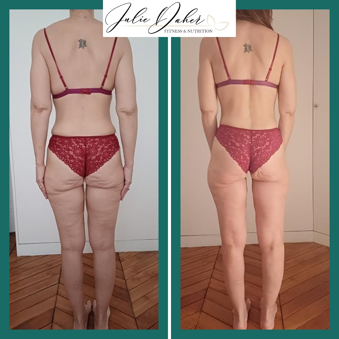 ✨ Transformation Inspirante : Hakima ✨⬇️
Quand Hakima est venue me voir, elle se sentait perdue.
Après 3 ans d’entraînement régulier en salle et d’essais de différents programmes de musculation, les résultats n’étaient pas au rendez-vous.
Femme d’affaires au planning surchargé et maman de 3 enfants, elle trouvait toujours du temps pour s’entraîner. Pourtant, malgré ses efforts, elle stagnait et ne savait plus comment avancer.
🔑 Ce qu’elle voulait ?
• Transformer son physique, avec une silhouette plus tonifiée et athlétique, retrouver force et confiance en elle.
• Adopter une hygiène de vie qui lui donnerait l’énergie nécessaire pour profiter pleinement de sa famille.
• Éviter les régimes restrictifs et trouver une routine durable et motivante.
🙌 Ses craintes ?
Que le coaching à distance ne soit pas suffisamment engageant.
👉 Ses objectifs ?
• Remodeler son corps après un passé marqué par l’obésité (115 kg).
• Réduire la distension cutanée au niveau des bras et des fessiers.
• Reprendre confiance en elle et retrouver une énergie débordante.
🎯 Ce qu’elle a obtenu grâce à un accompagnement 100 % personnalisé :
💪 Une routine sportive adaptée à son emploi du temps.
🍎 Une alimentation équilibrée, sans frustration ni privation.
🧠 Un mental renforcé pour relever les défis du quotidien.
✅Les résultats ?
✔️ Une perte de gras visible et un gain de masse musculaire, raffermissant son corps.
✔️ Un regain d’énergie, un sommeil de qualité et moins de fatigue.
✔️ Une confiance retrouvée, qui rayonne dans tous les aspects de sa vie.
👉 Tu hésites à te lancer ?
Elle te dirait : « Ce coaching va bien au-delà d’un simple programme sportif. C’est une transformation globale, physique et mentale. Arrête d’attendre le moment parfait, il n’existe pas. Lance-toi maintenant, fais-toi confiance et découvre de quoi tu es vraiment capable. »
💌 Et toi, prêt(e) à écrire ta propre histoire ?
👉 DM le mot “START” et commence ta transformation dès aujourd’hui !
.
.
.
#transformation #musculation #pertedepoids #goals #fitnesstransformation #bodybuilding #bodytransformation #musculationfemme #transformationphysique #clientwin #coaching #mamansportive #changerdevie